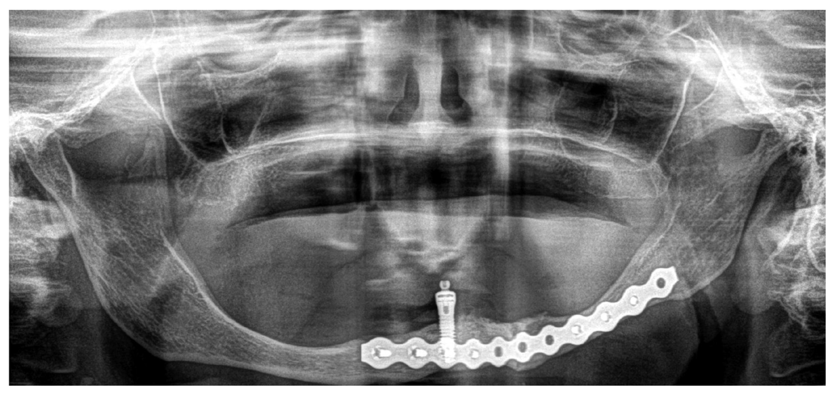 Medicina 60 01835 g007