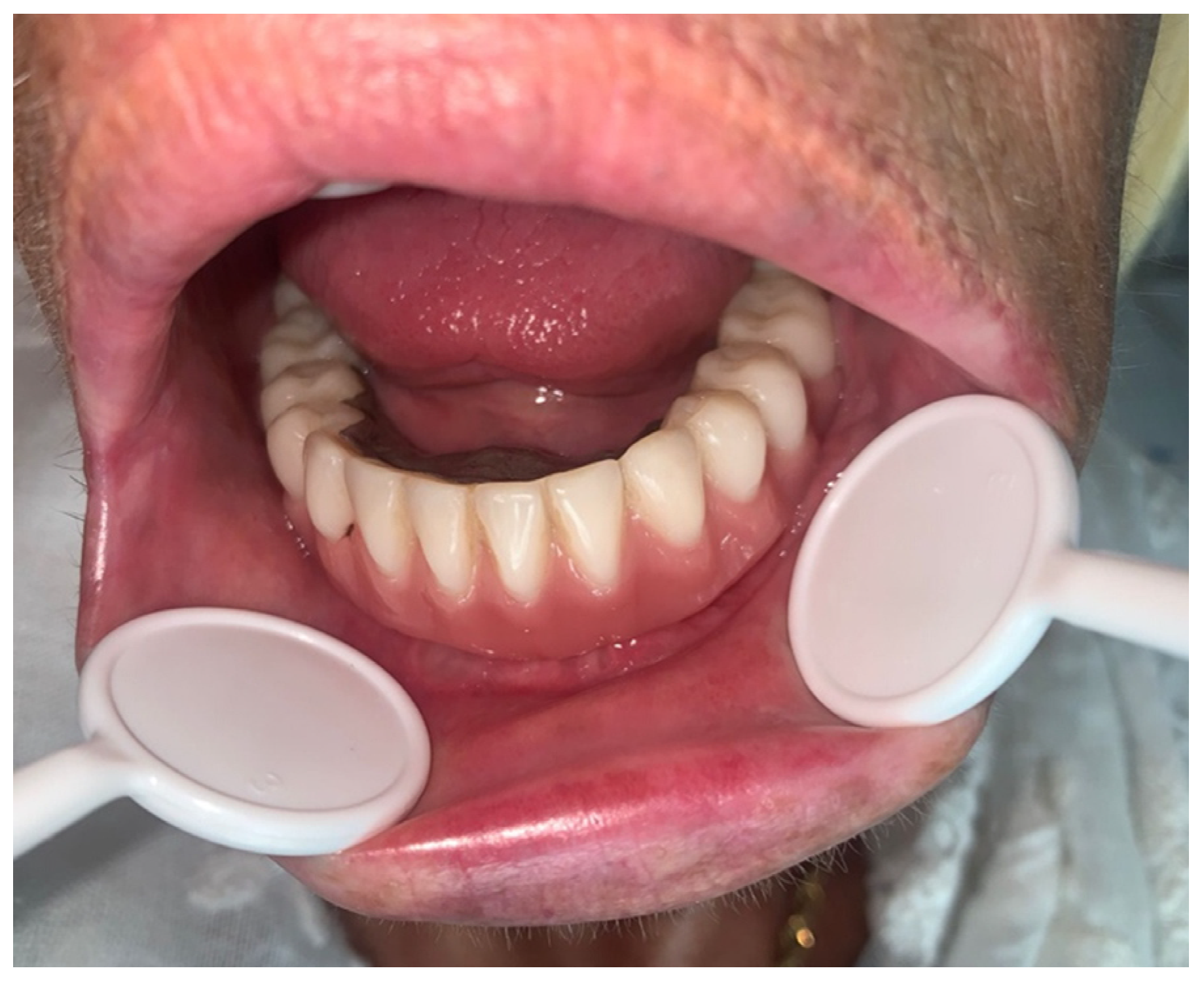 Medicina 60 01835 g008