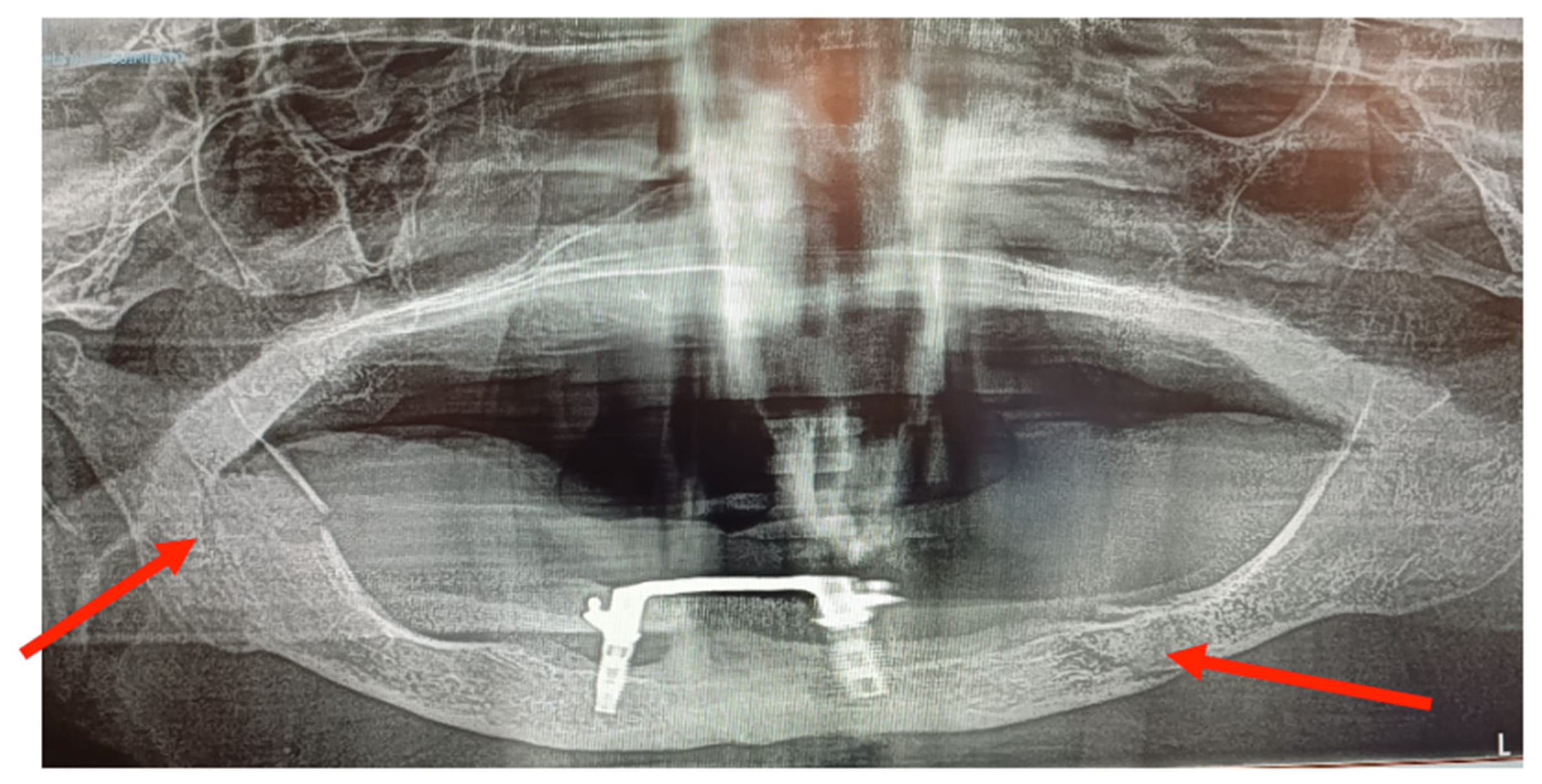 Medicina 60 01835 g009