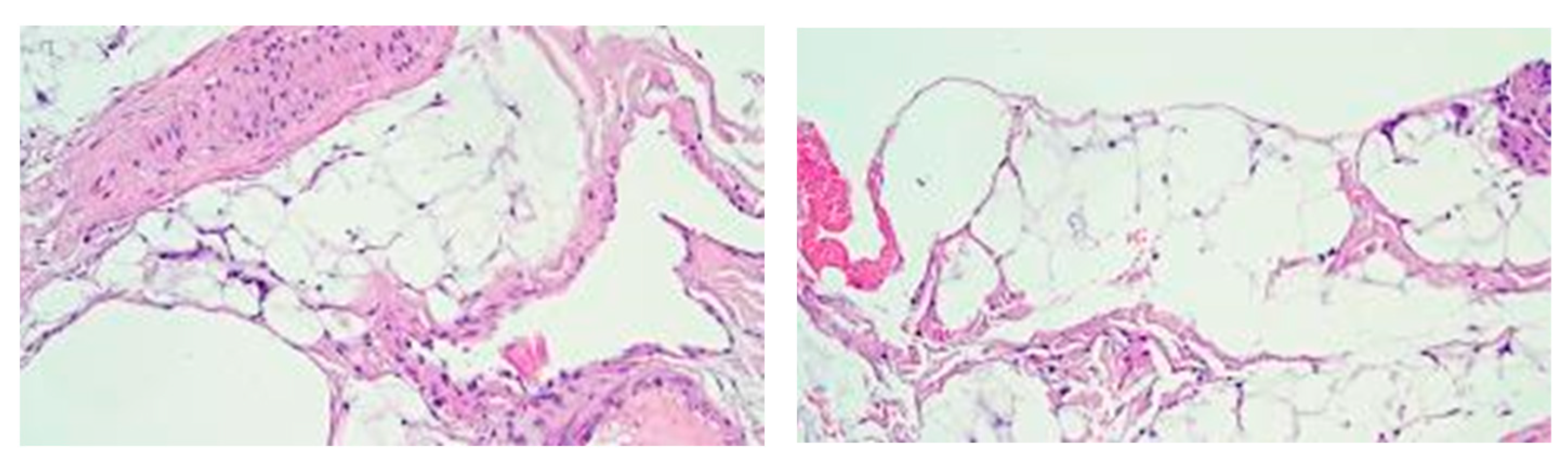 Medicina 60 01836 g005