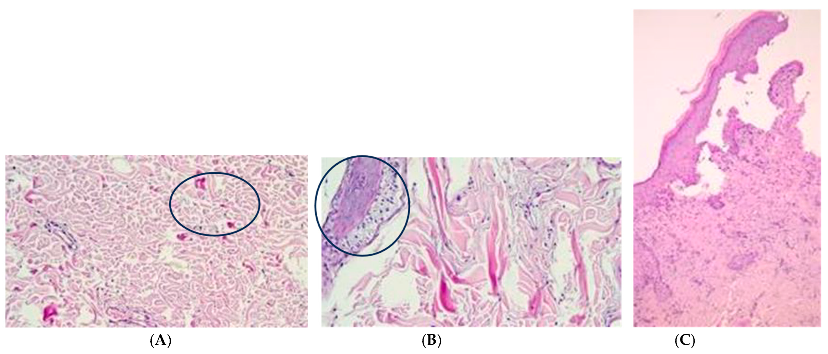 Medicina 60 01836 g006