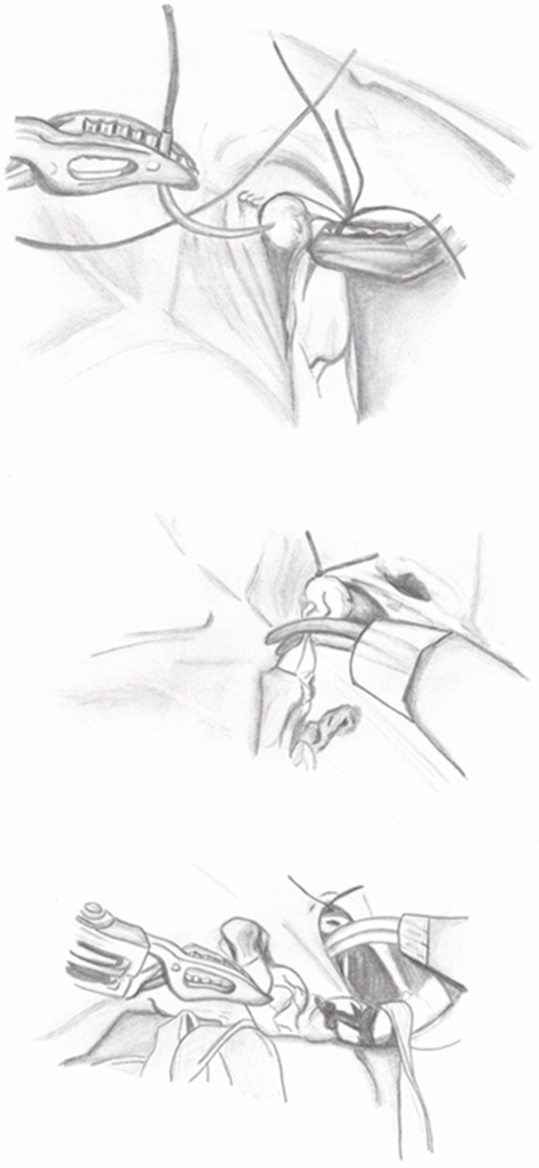 Medicina 60 01837 g002