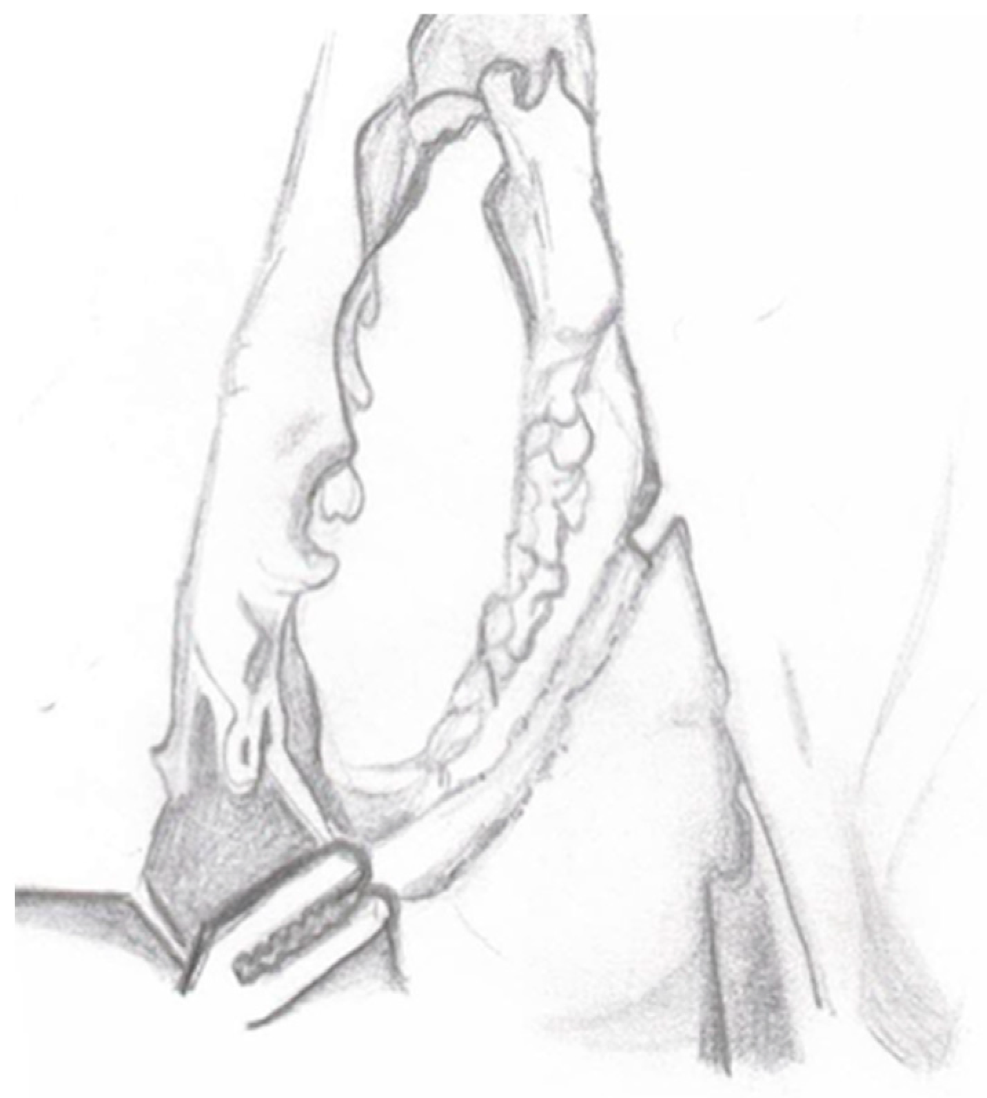 Medicina 60 01837 g003