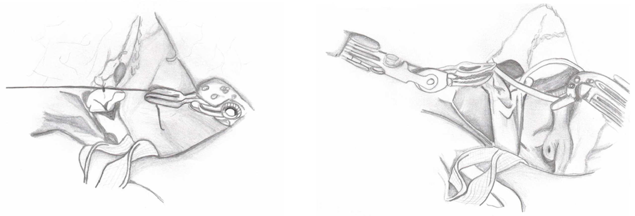 Medicina 60 01837 g005