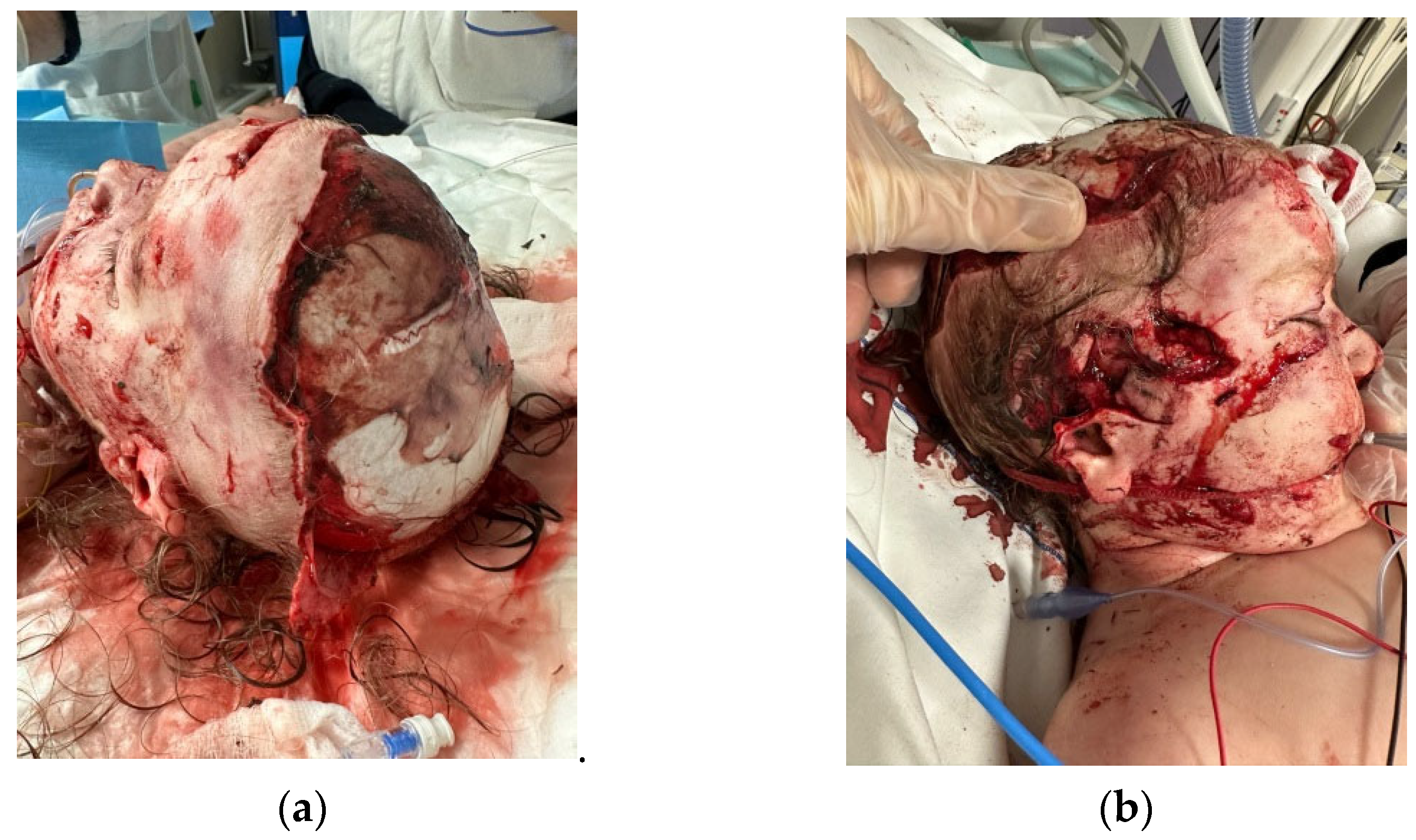 Medicina 60 01838 g001