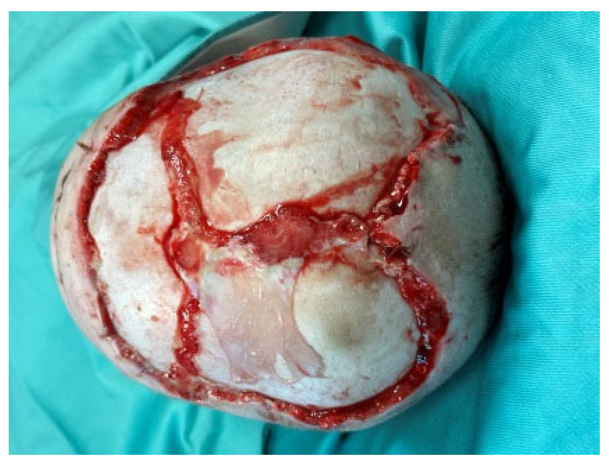 Medicina 60 01838 g002