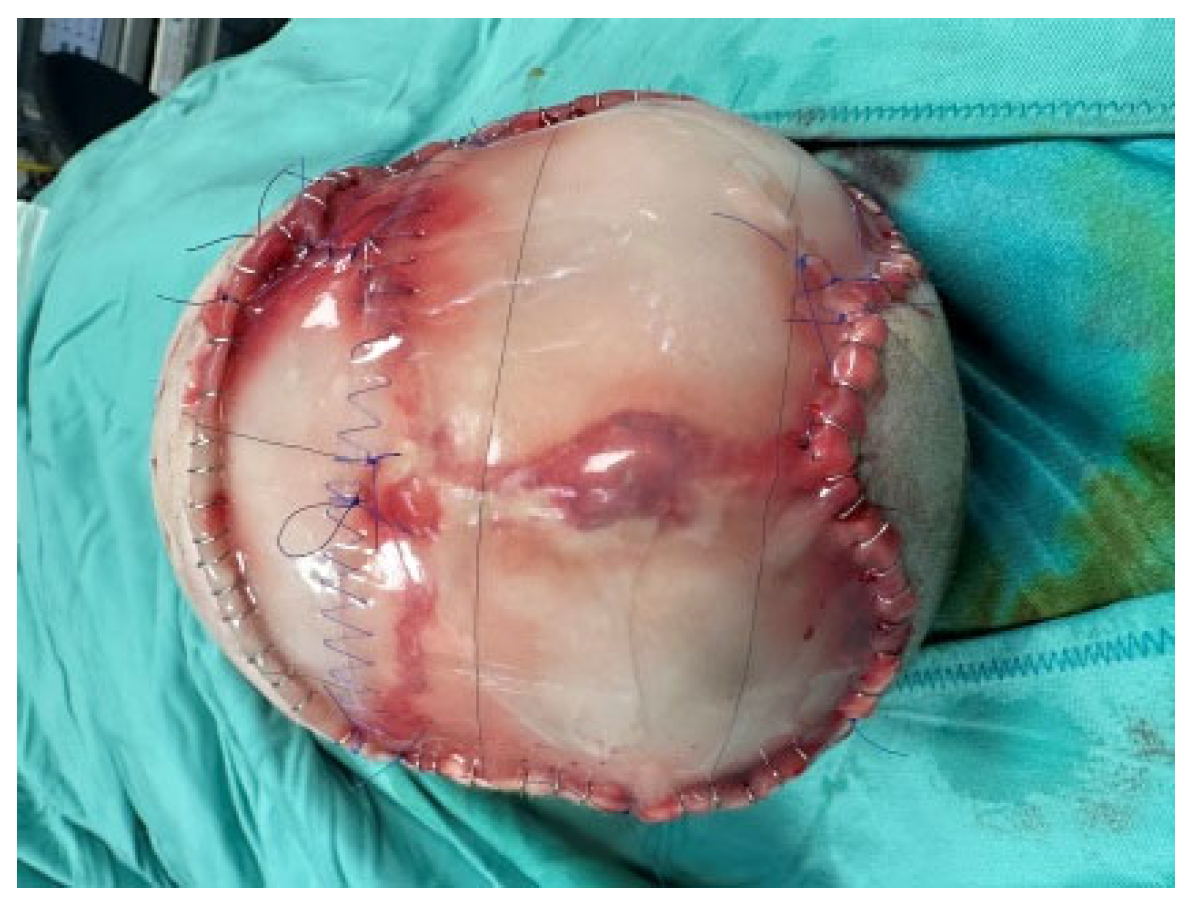 Medicina 60 01838 g003