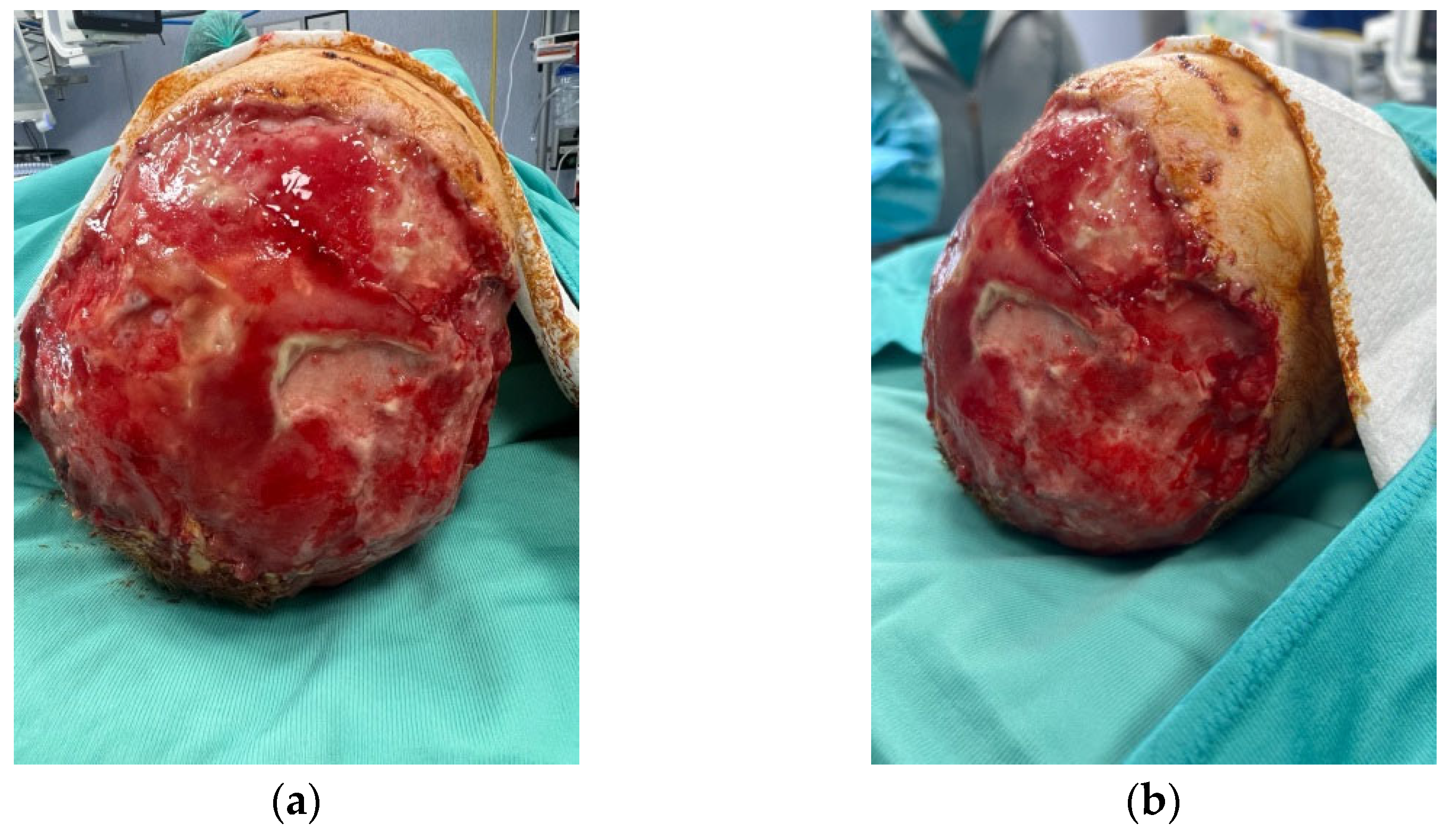 Medicina 60 01838 g006