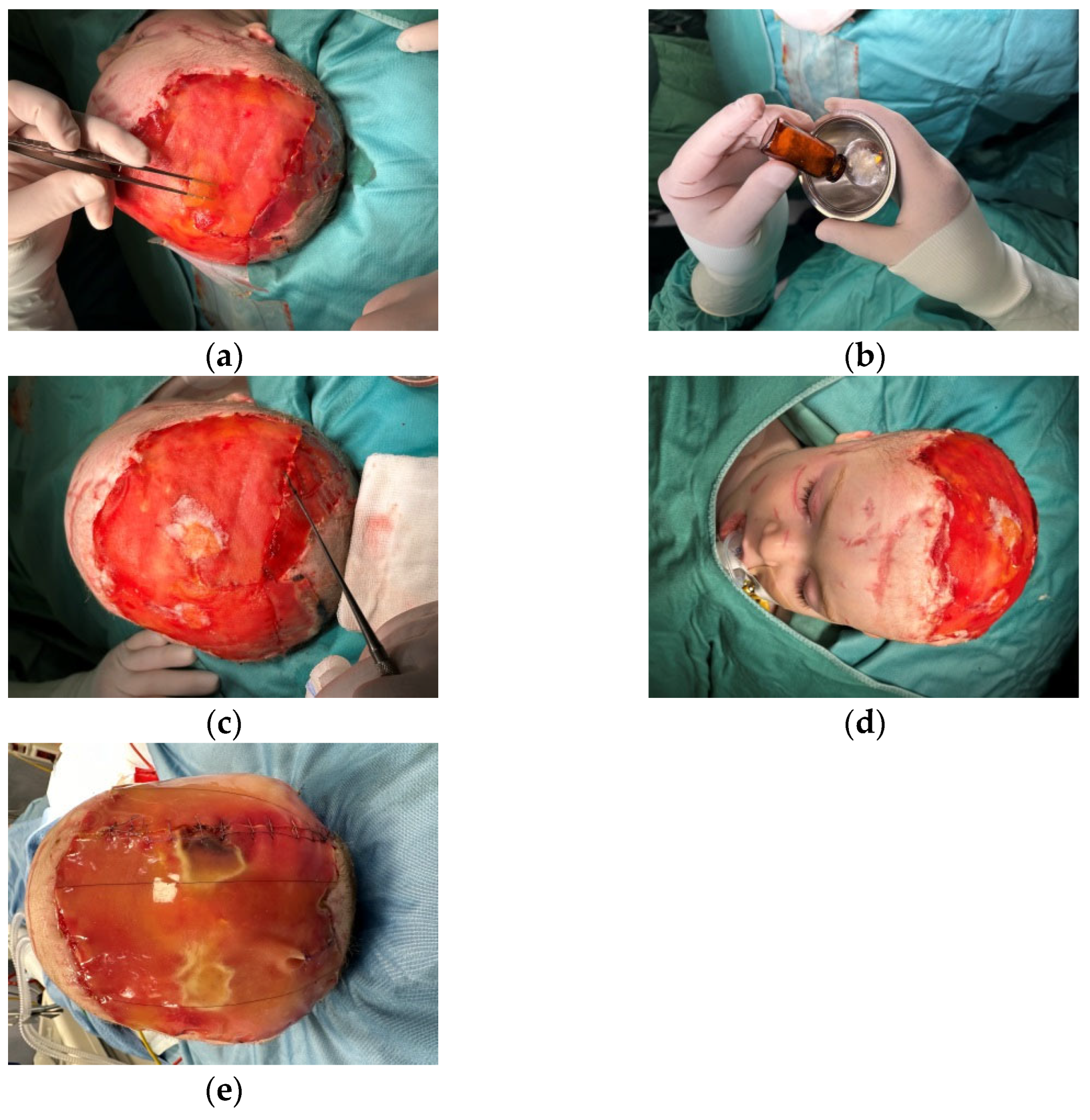 Medicina 60 01838 g007