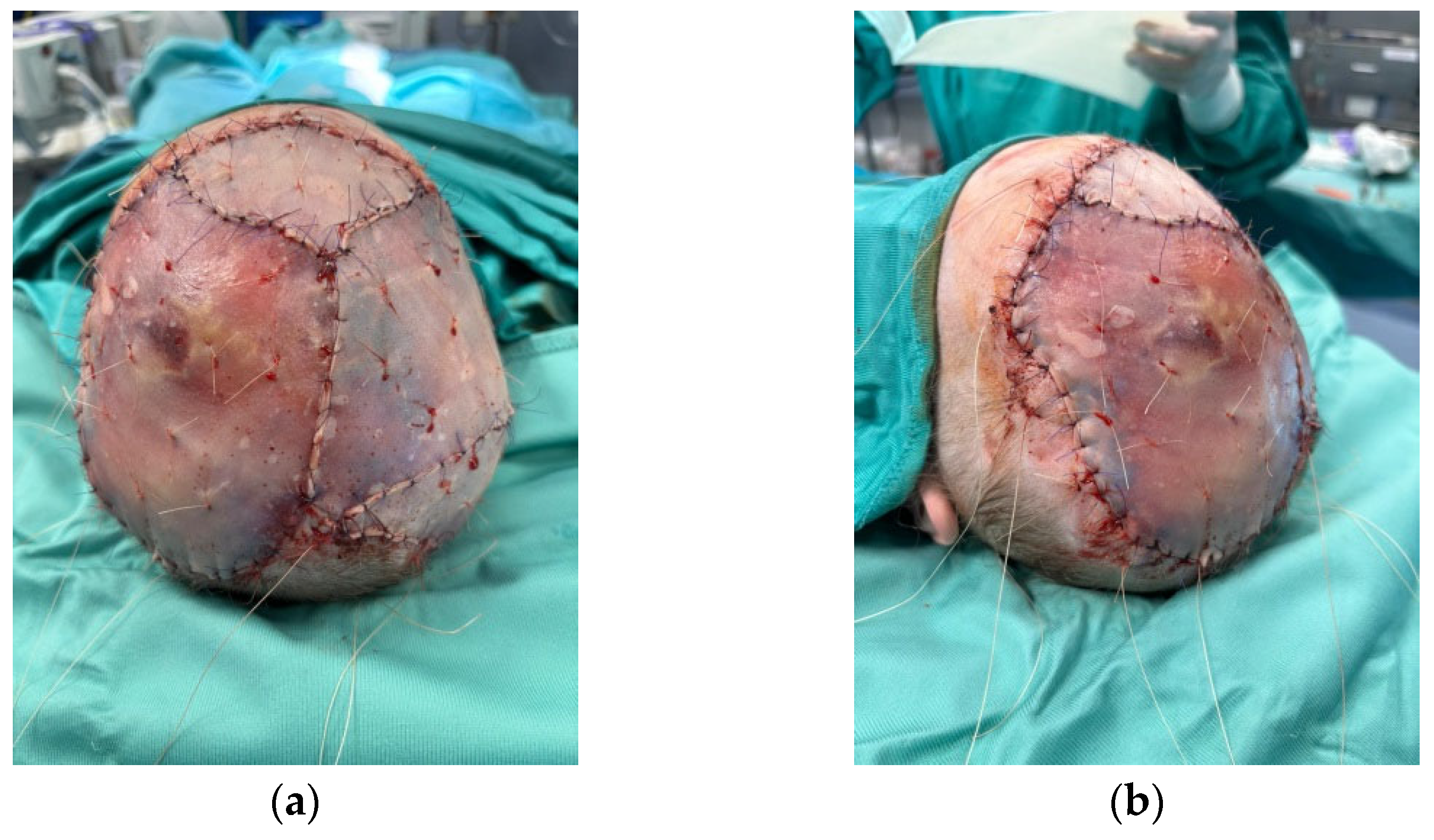 Medicina 60 01838 g008