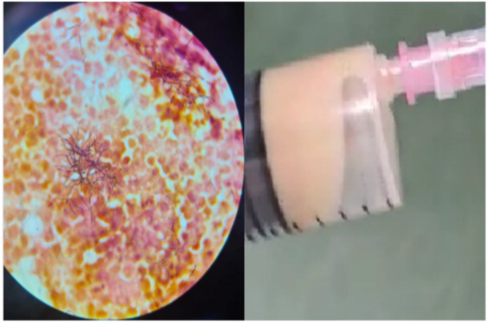 Medicina 60 01863 g004