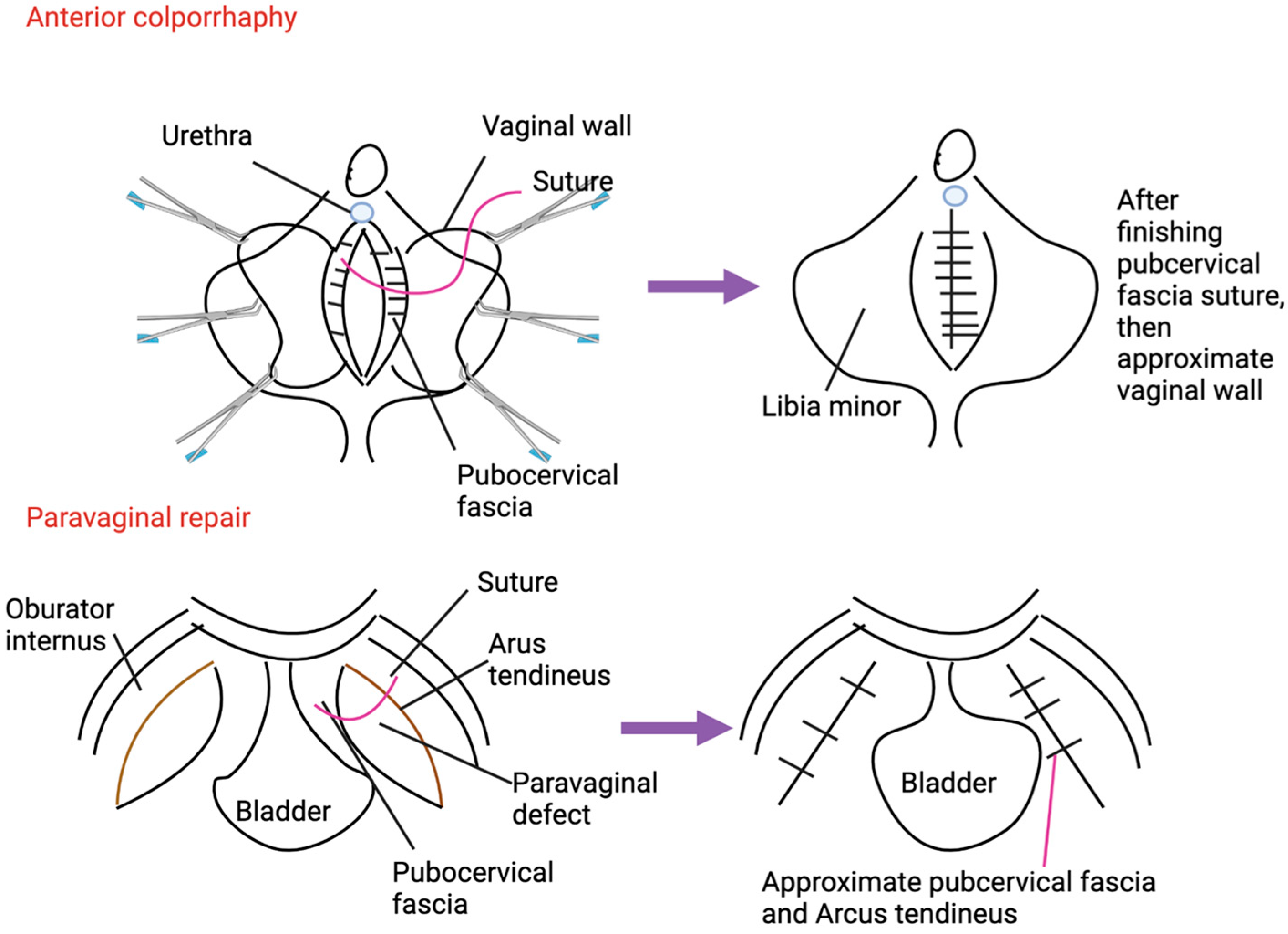 Medicina 60 01865 g001