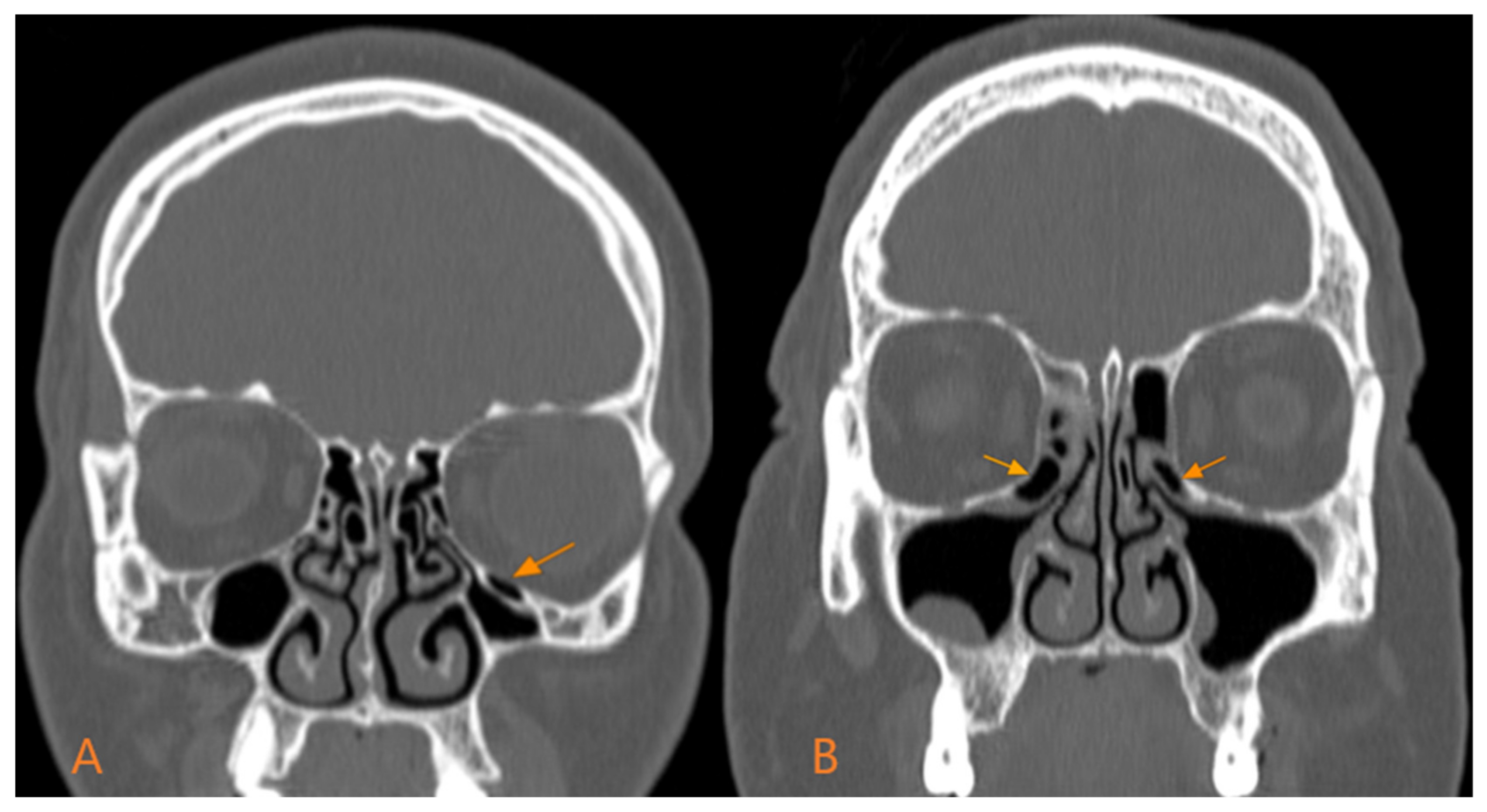 Medicina 60 01867 g001