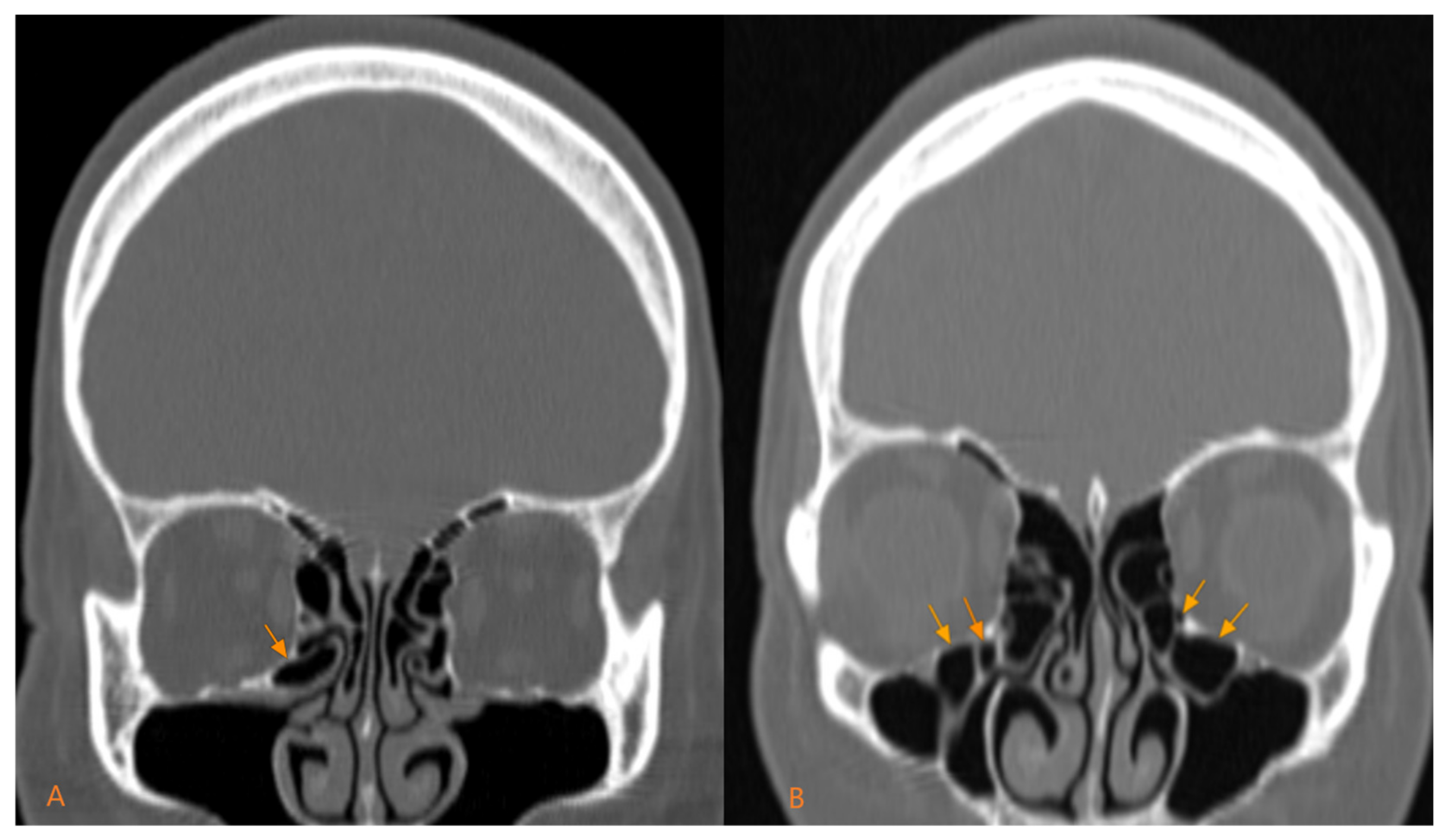 Medicina 60 01867 g002