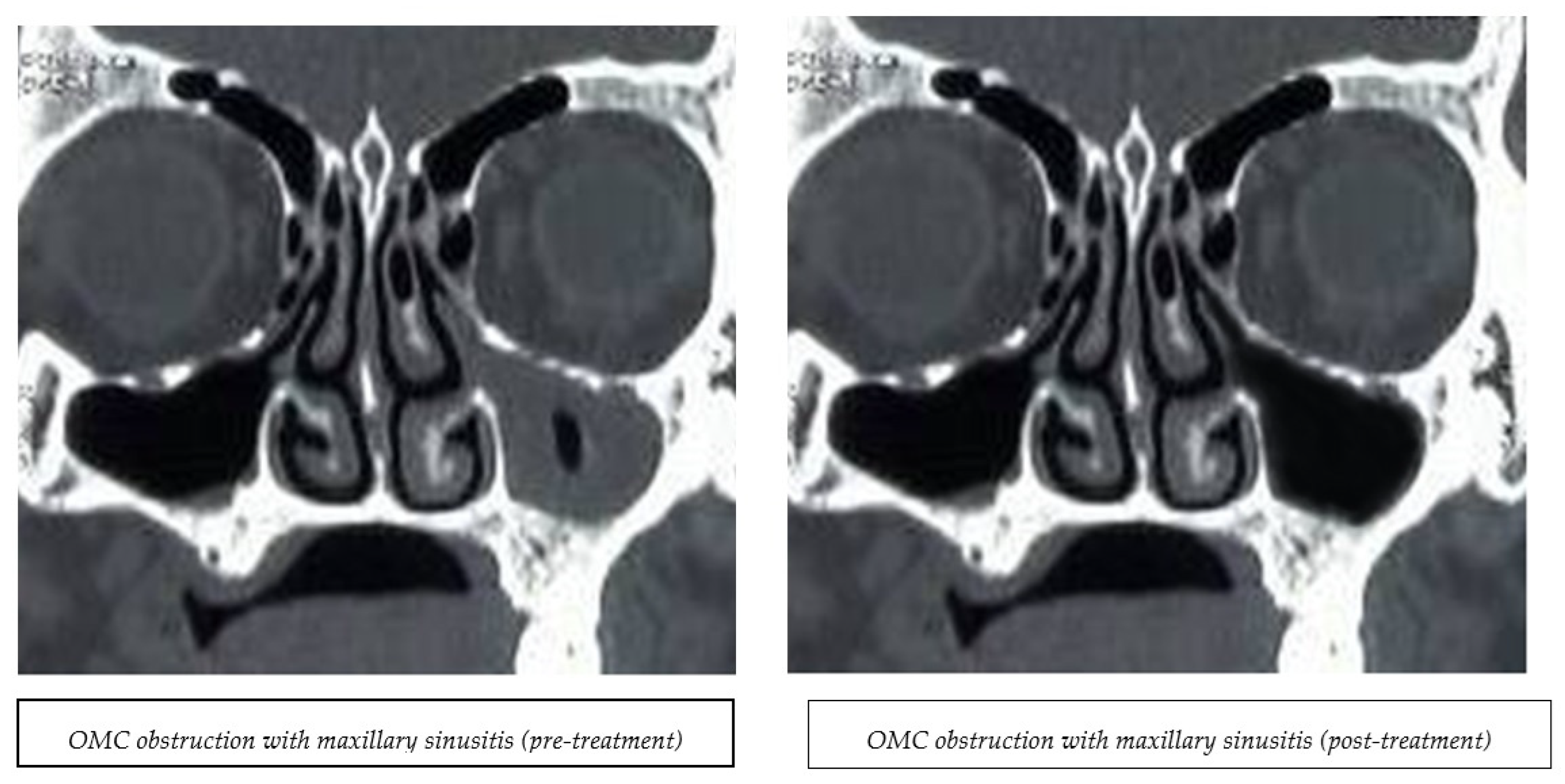 Medicina 60 01868 g002