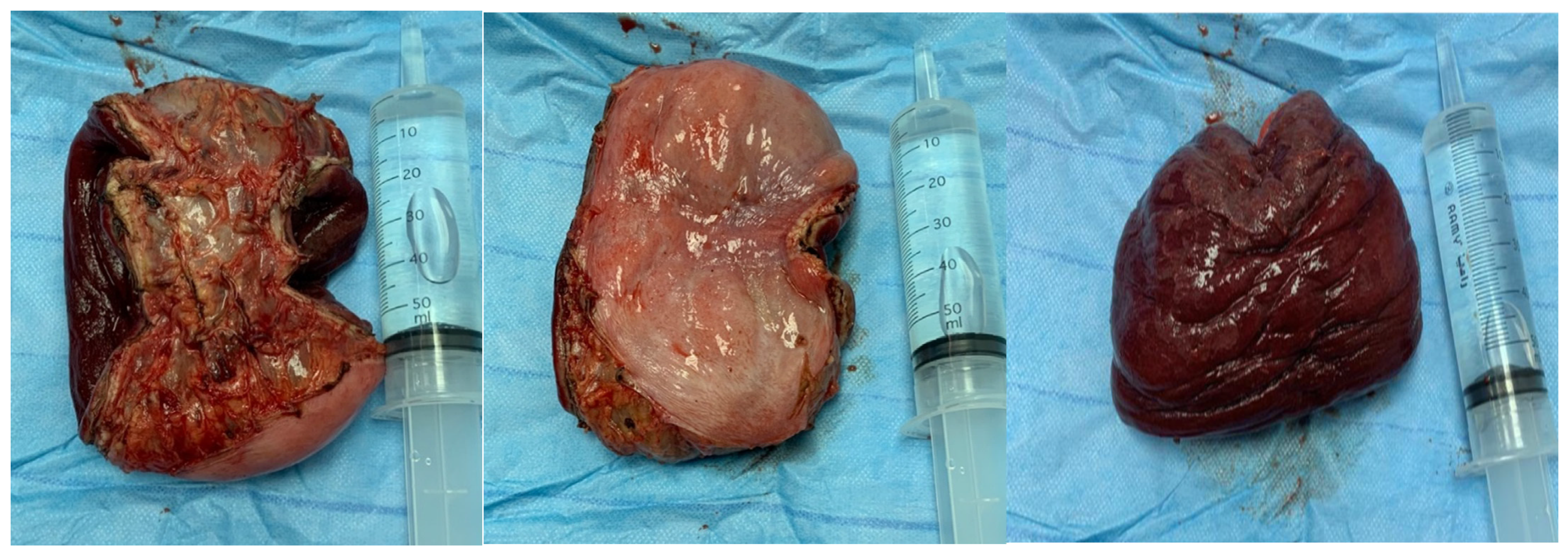 Medicina 60 01872 g002