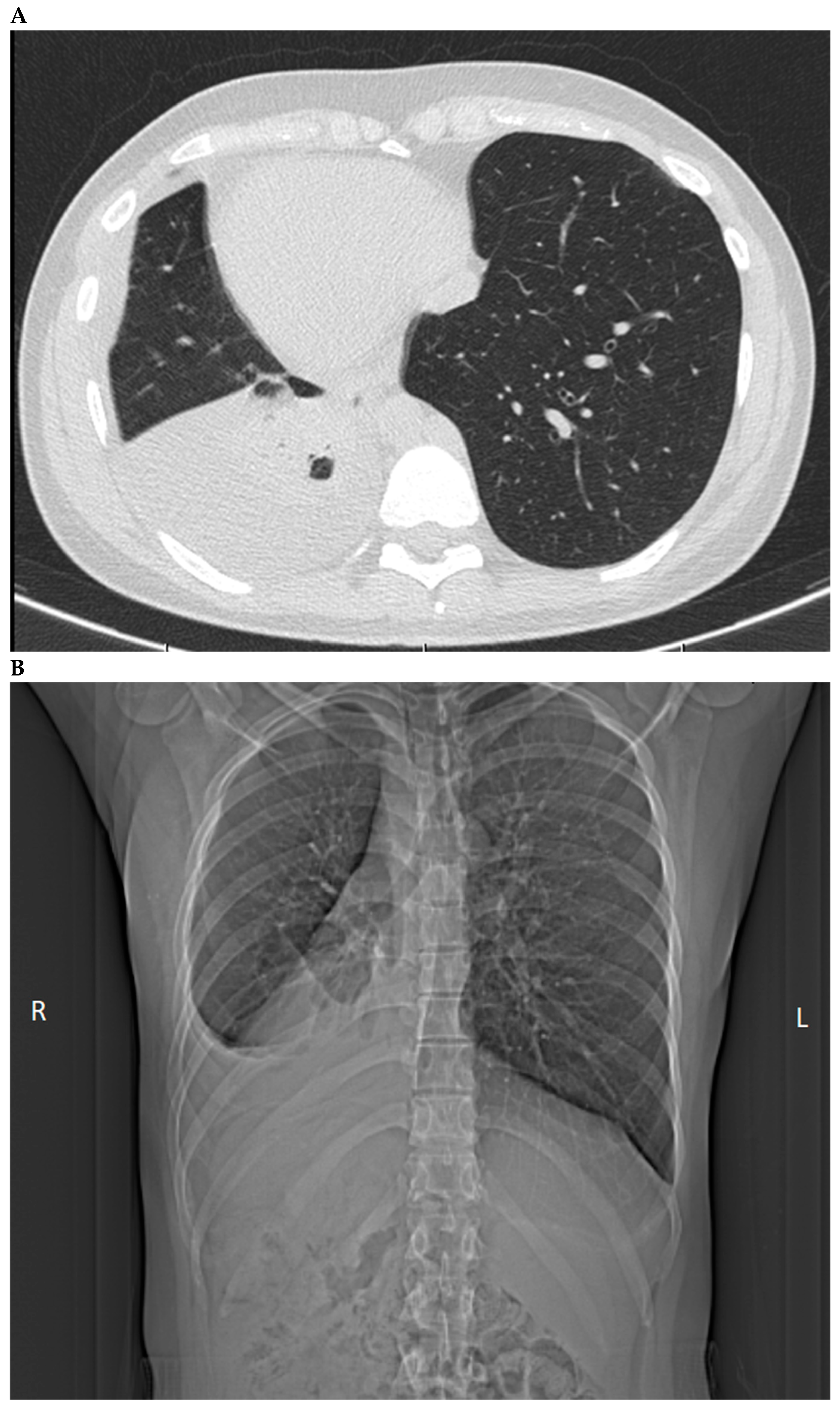 Medicina 60 01874 g004