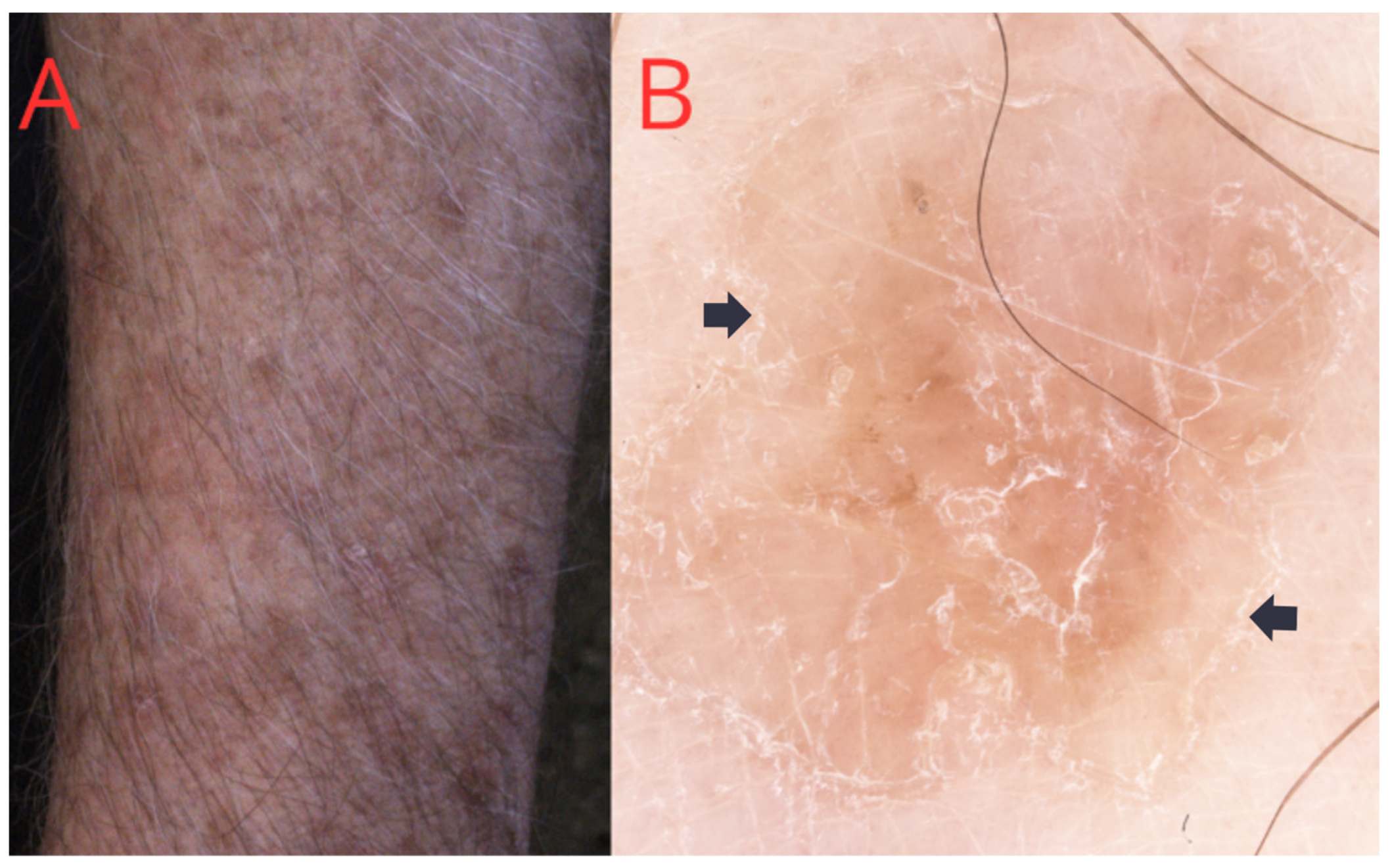 Medicina 60 01876 g002