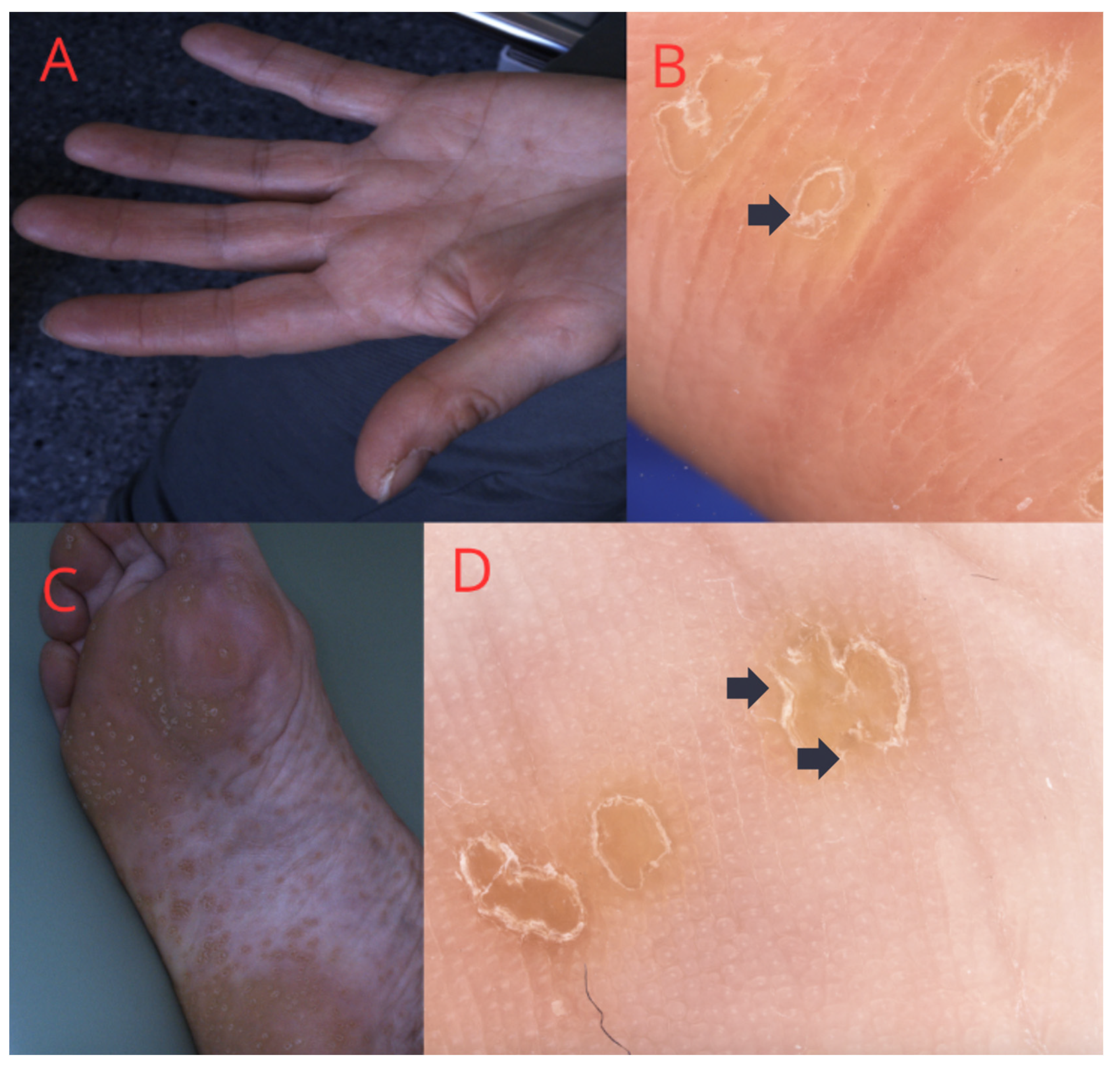 Medicina 60 01876 g005