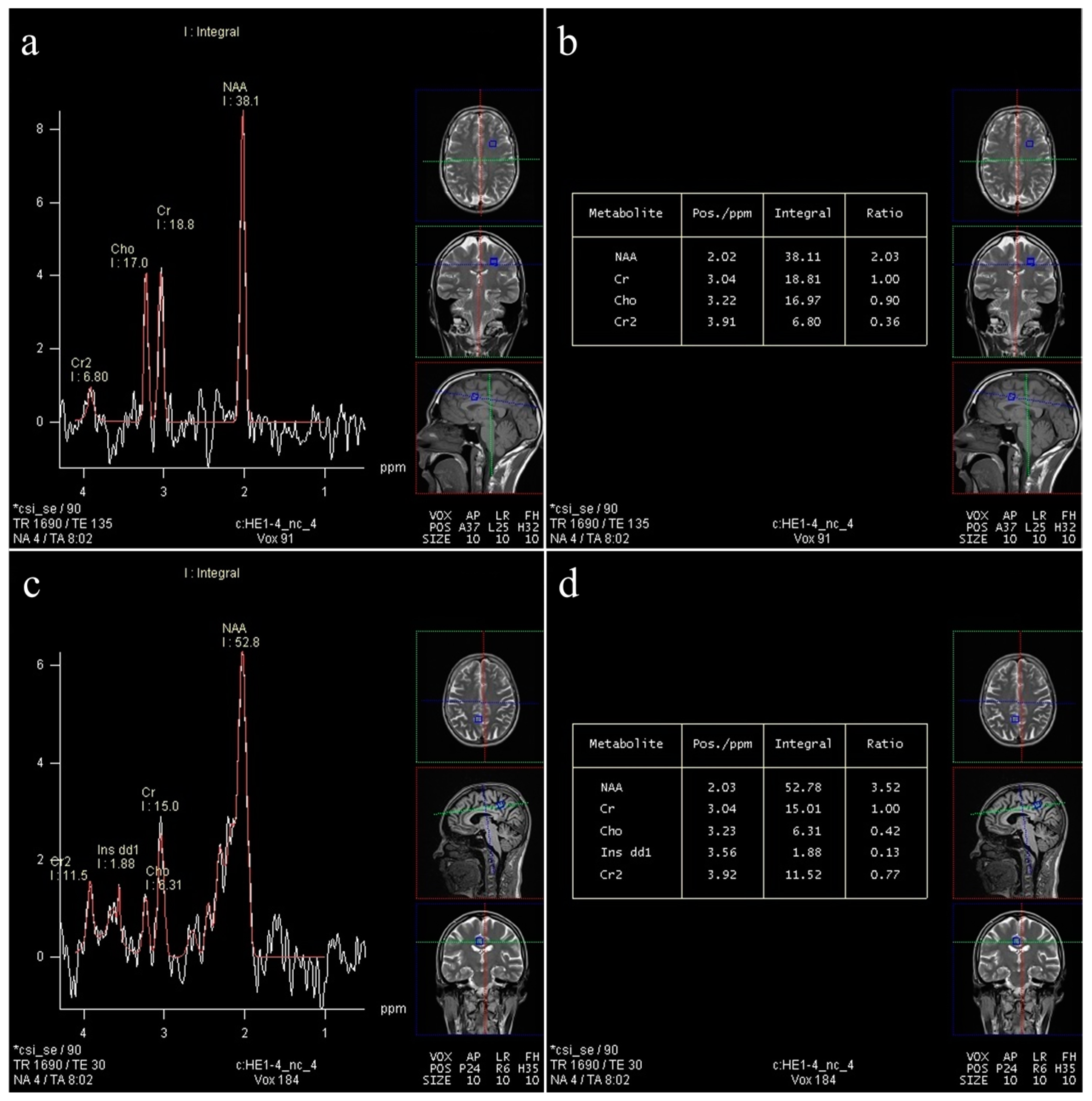 Medicina 60 01880 g002