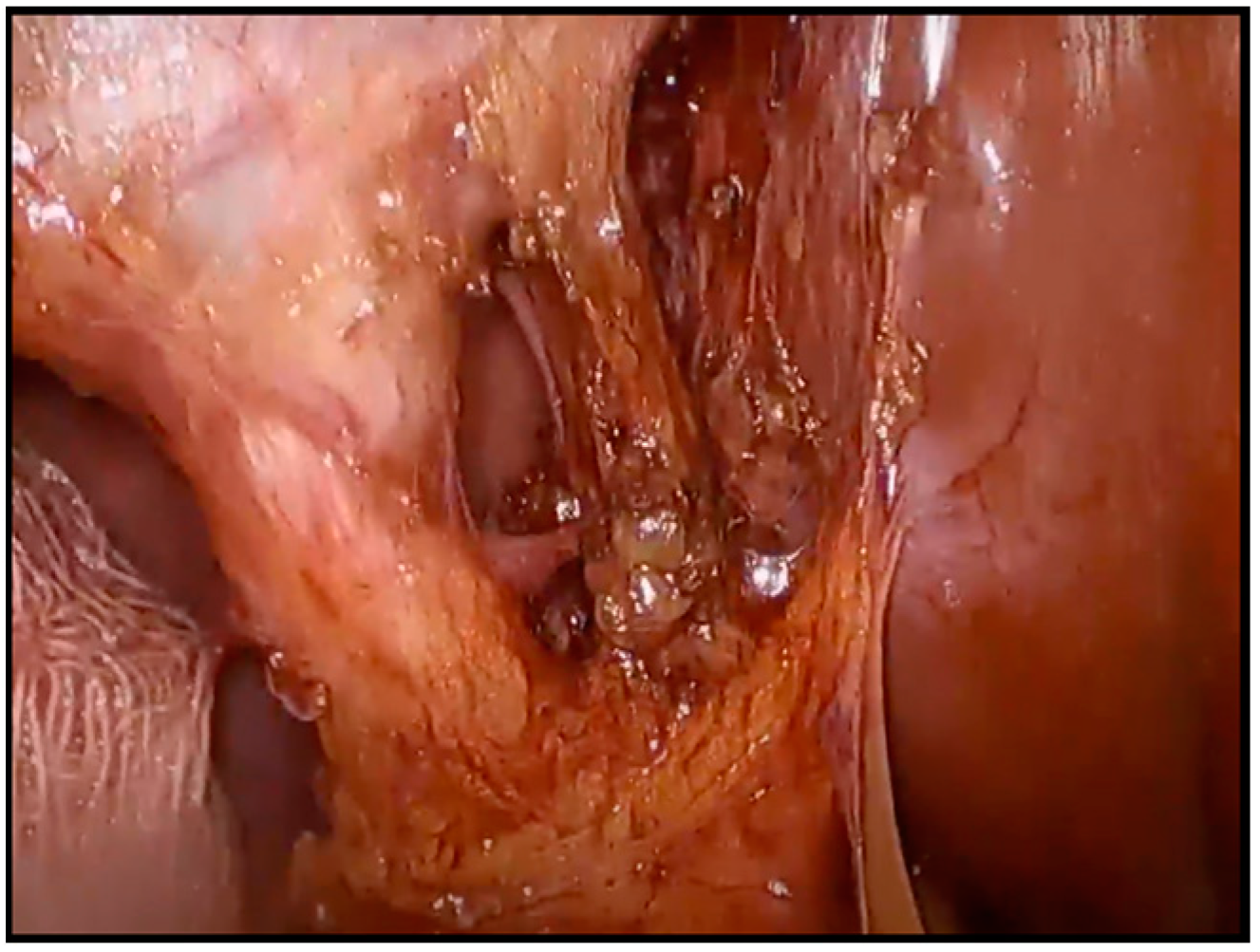 Medicina 60 01885 g001