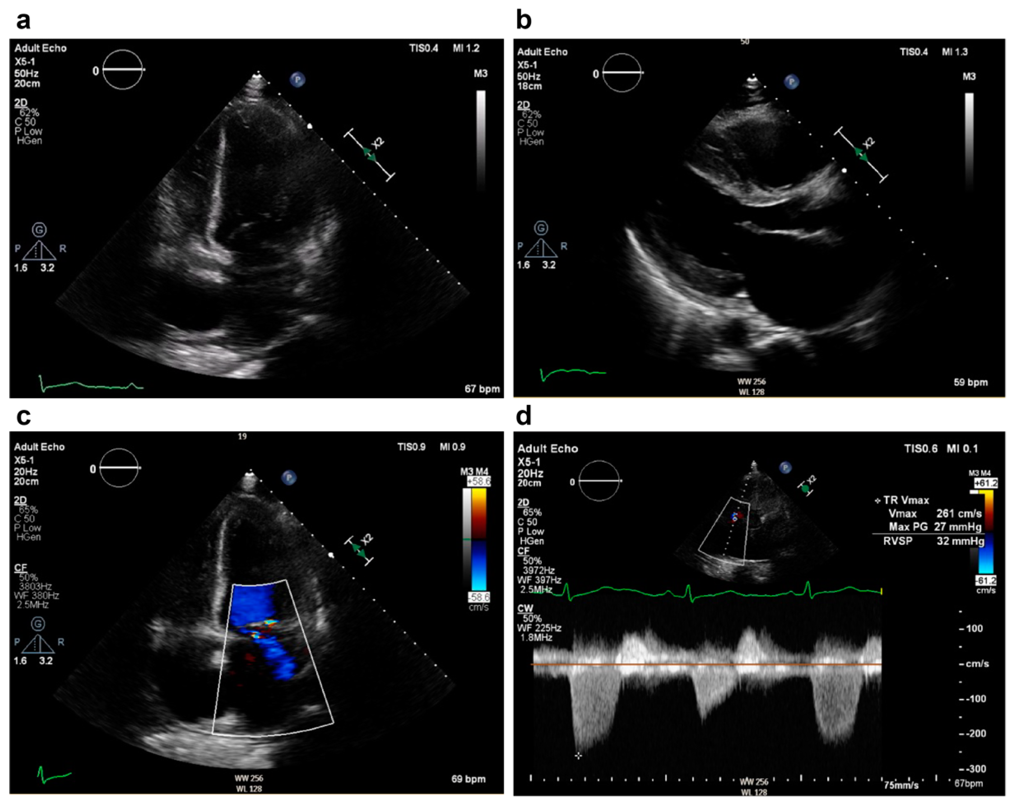 Medicina 60 01892 g001