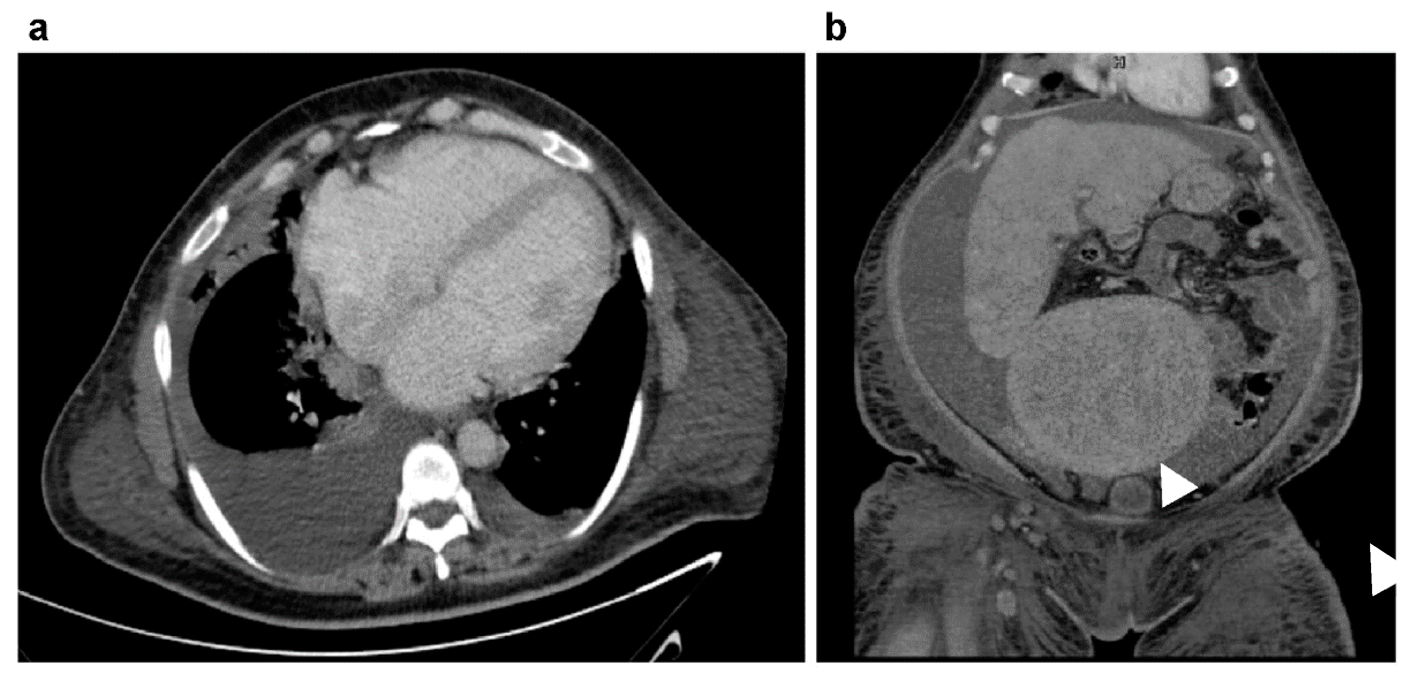 Medicina 60 01892 g002