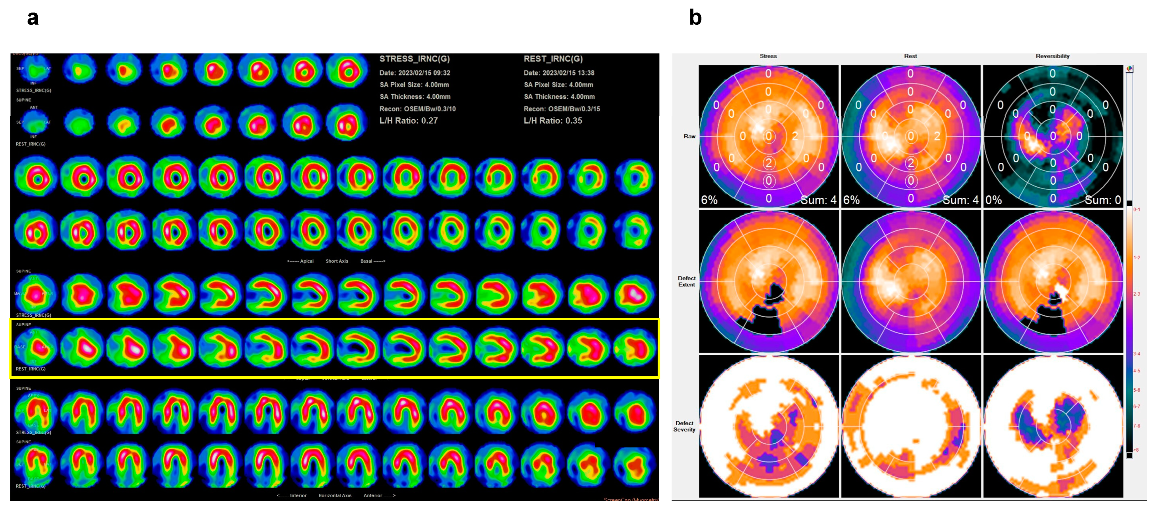 Medicina 60 01892 g003
