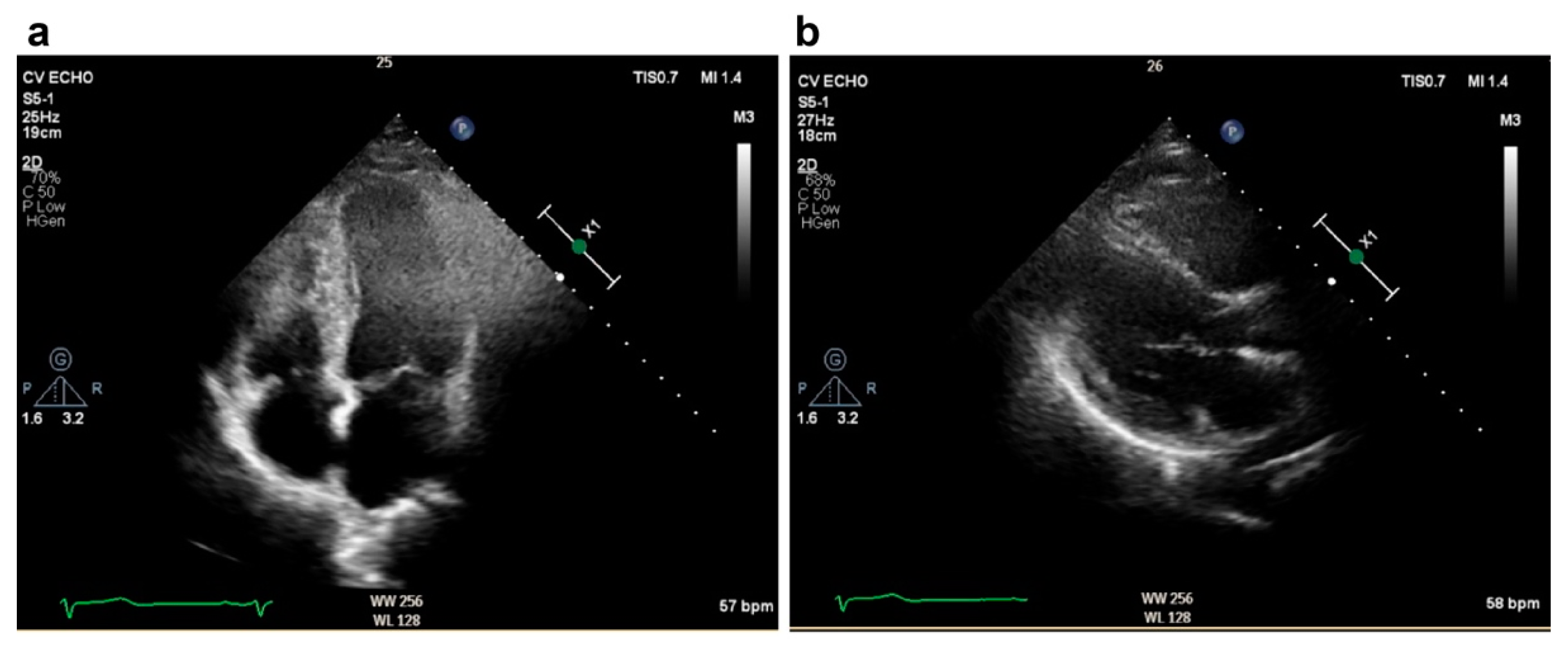 Medicina 60 01892 g005