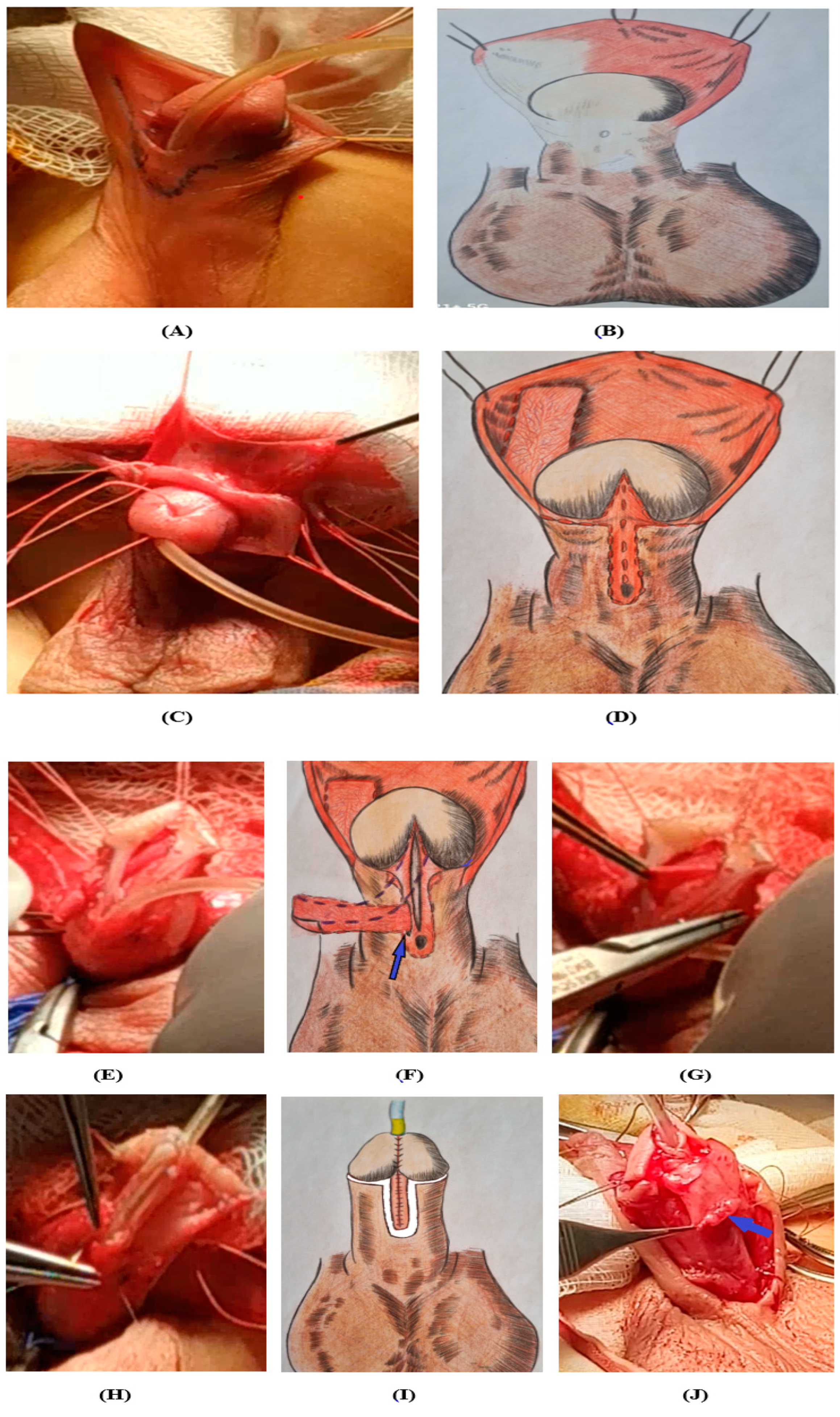 Medicina 60 01903 g002a