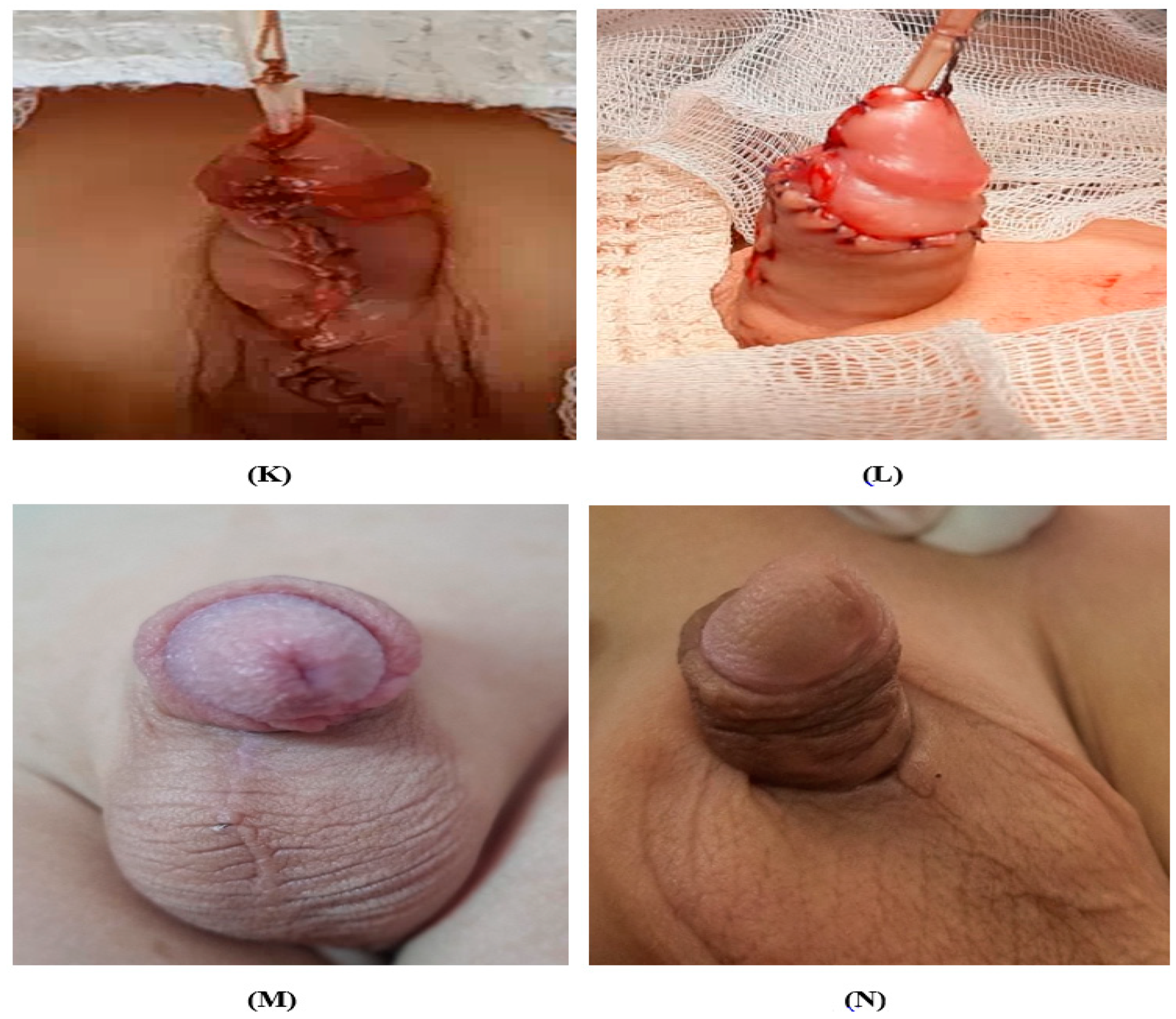 Medicina 60 01903 g002b