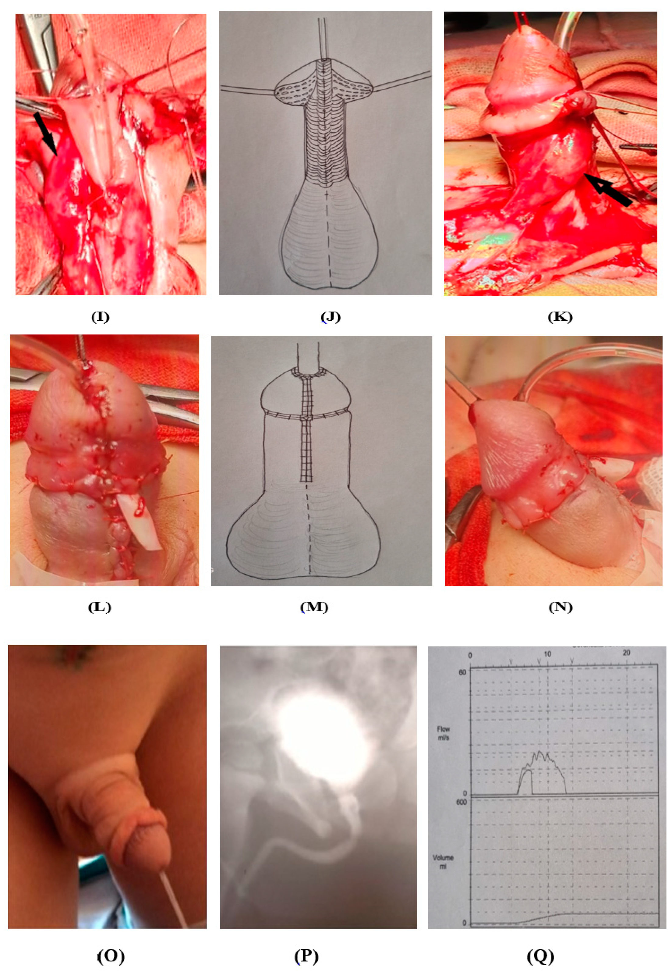 Medicina 60 01903 g003c