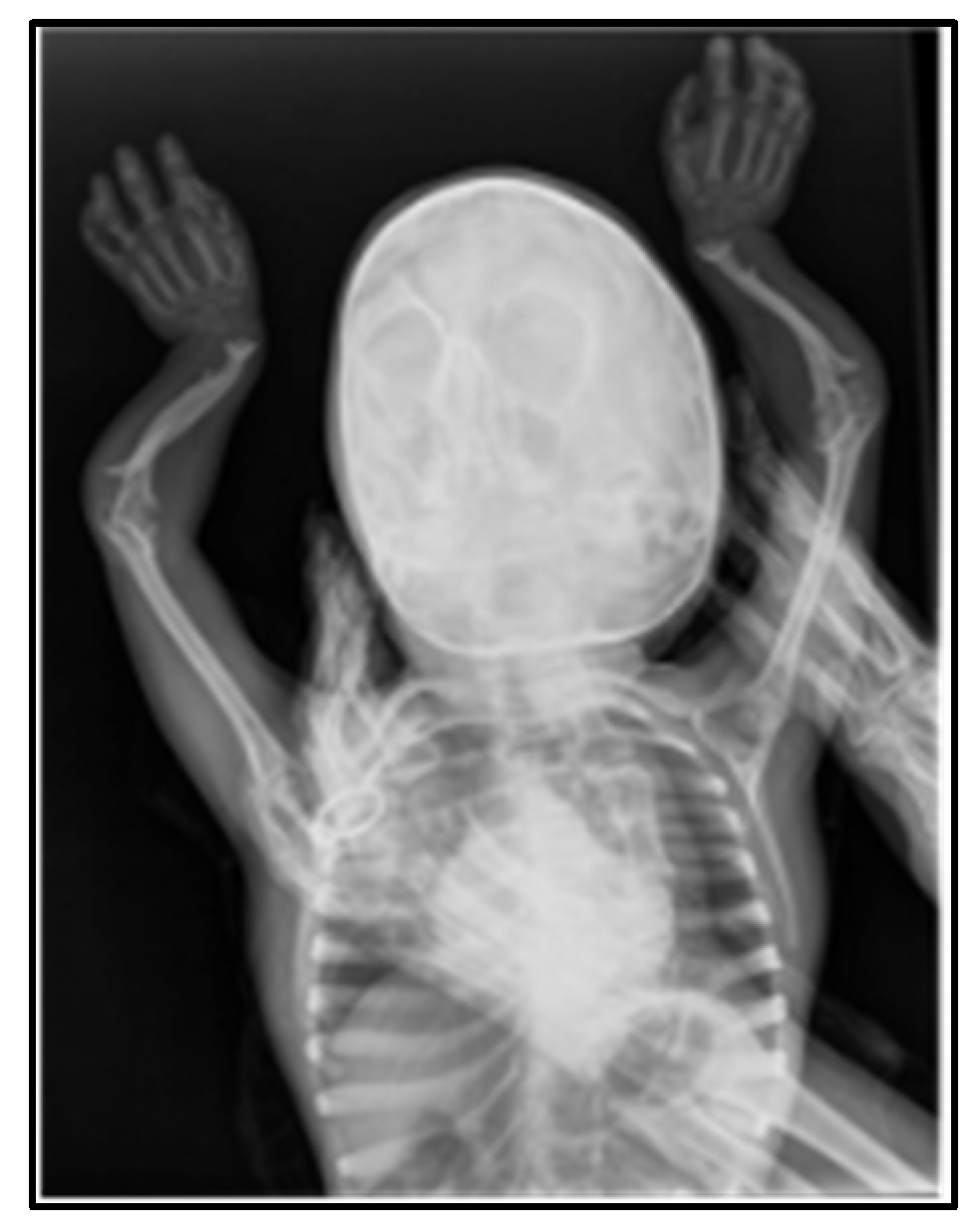 Medicina 60 01906 g003