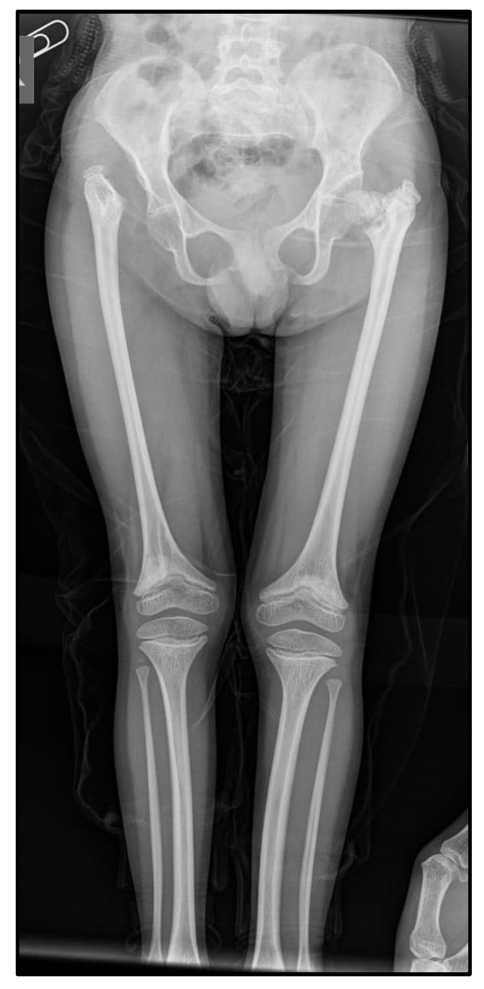 Medicina 60 01906 g004