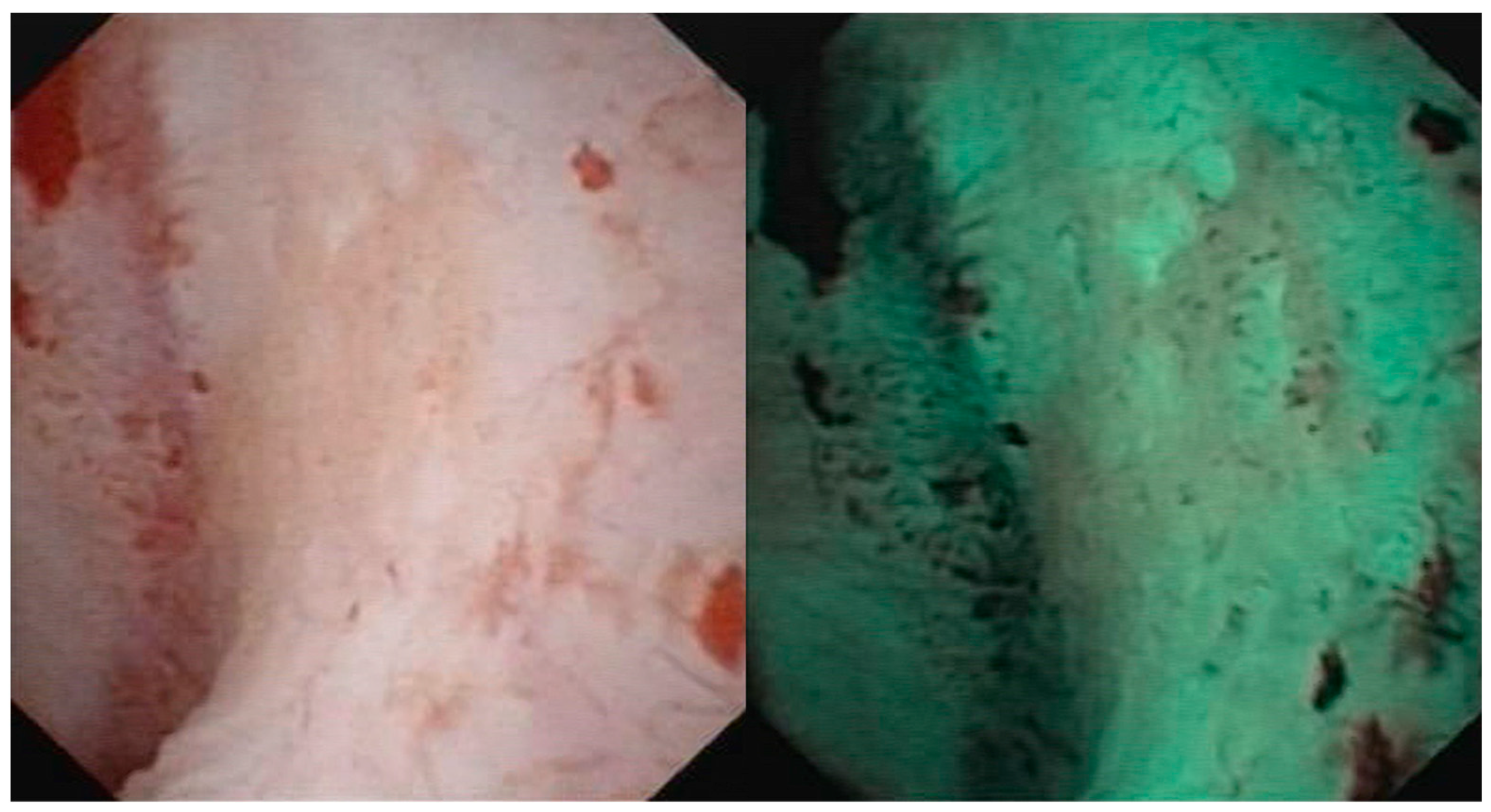 Medicina 60 01911 g002