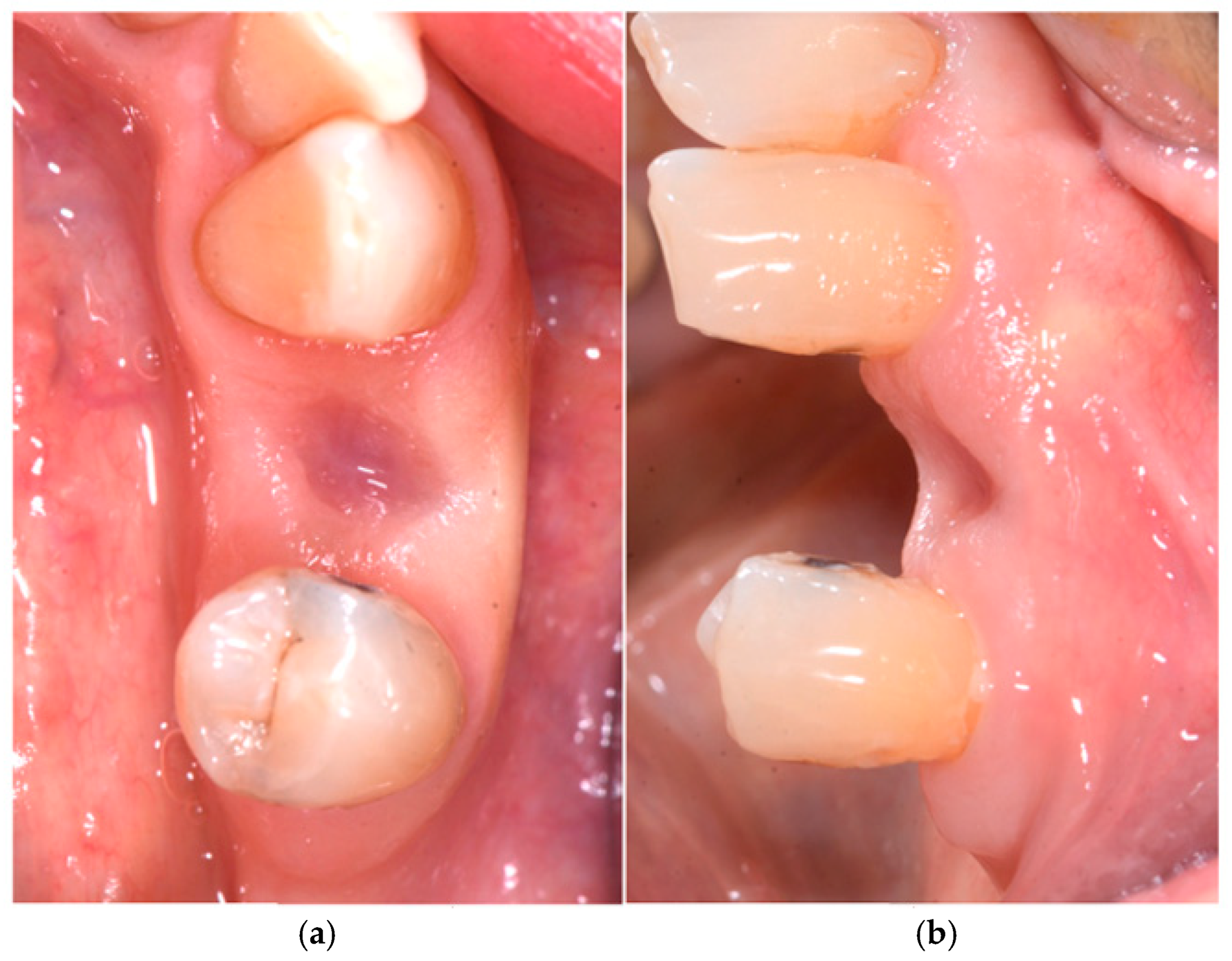 Medicina 60 01912 g003