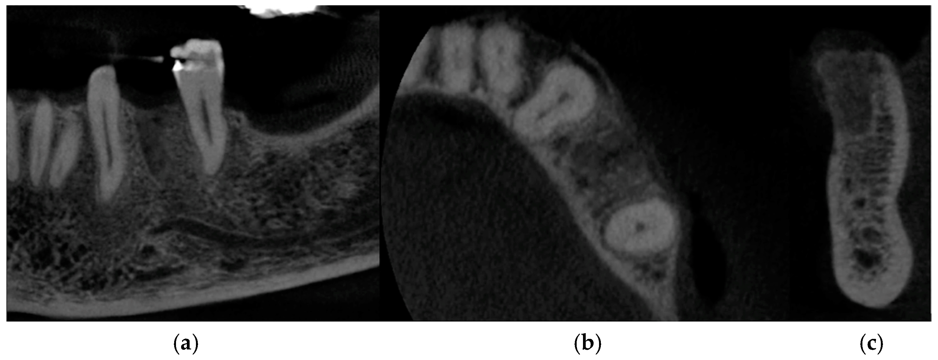 Medicina 60 01912 g004
