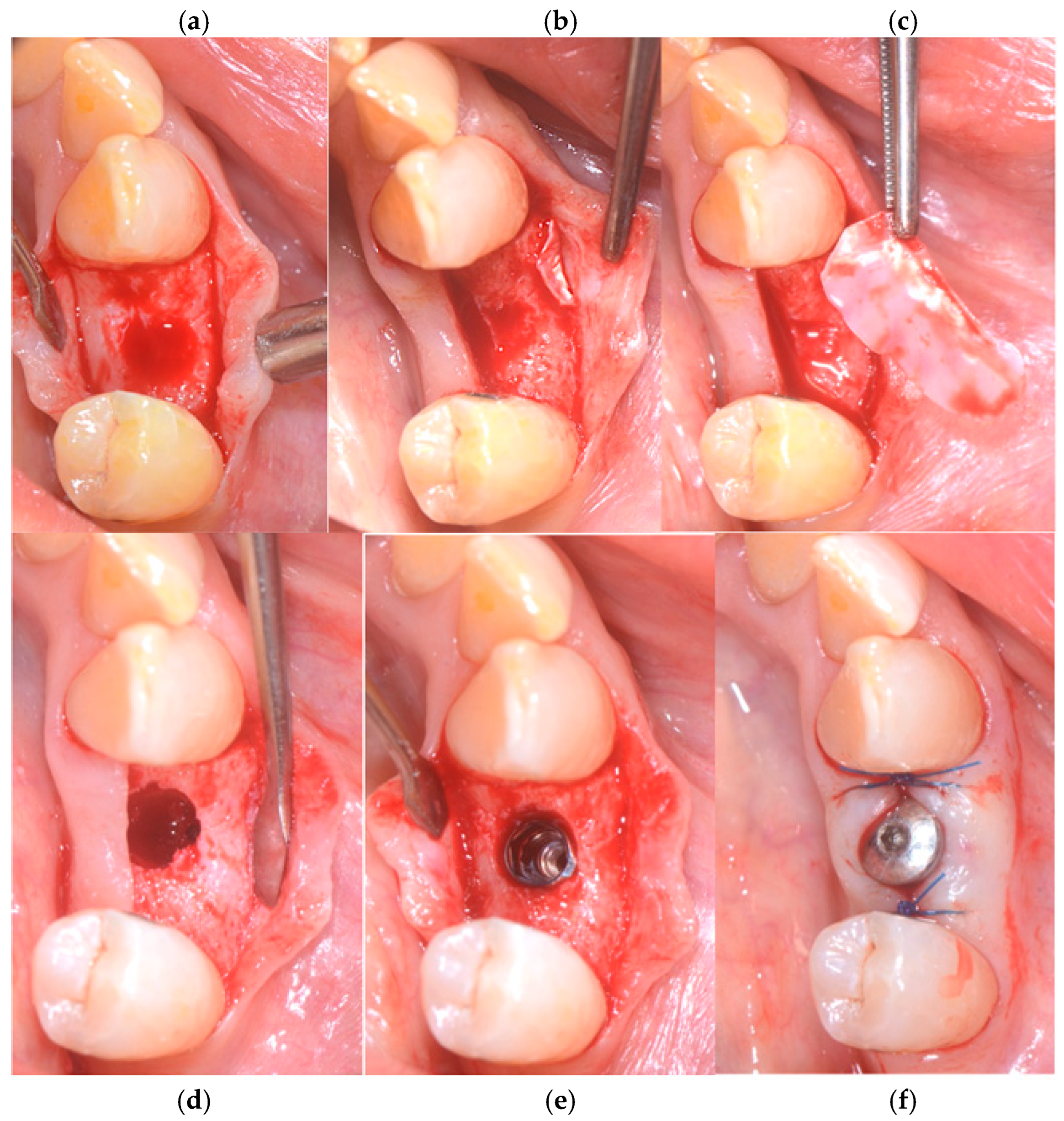 Medicina 60 01912 g005