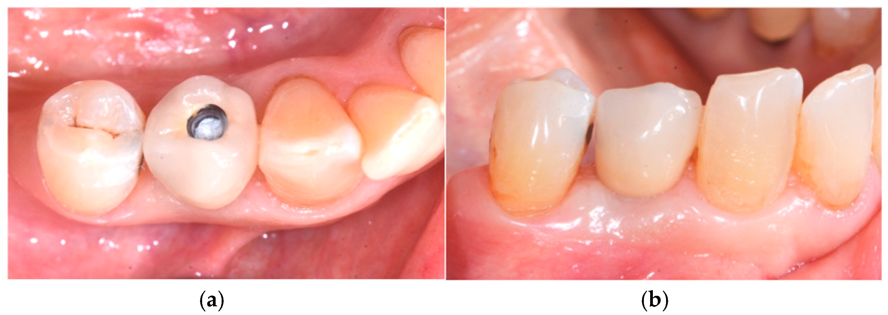 Medicina 60 01912 g007