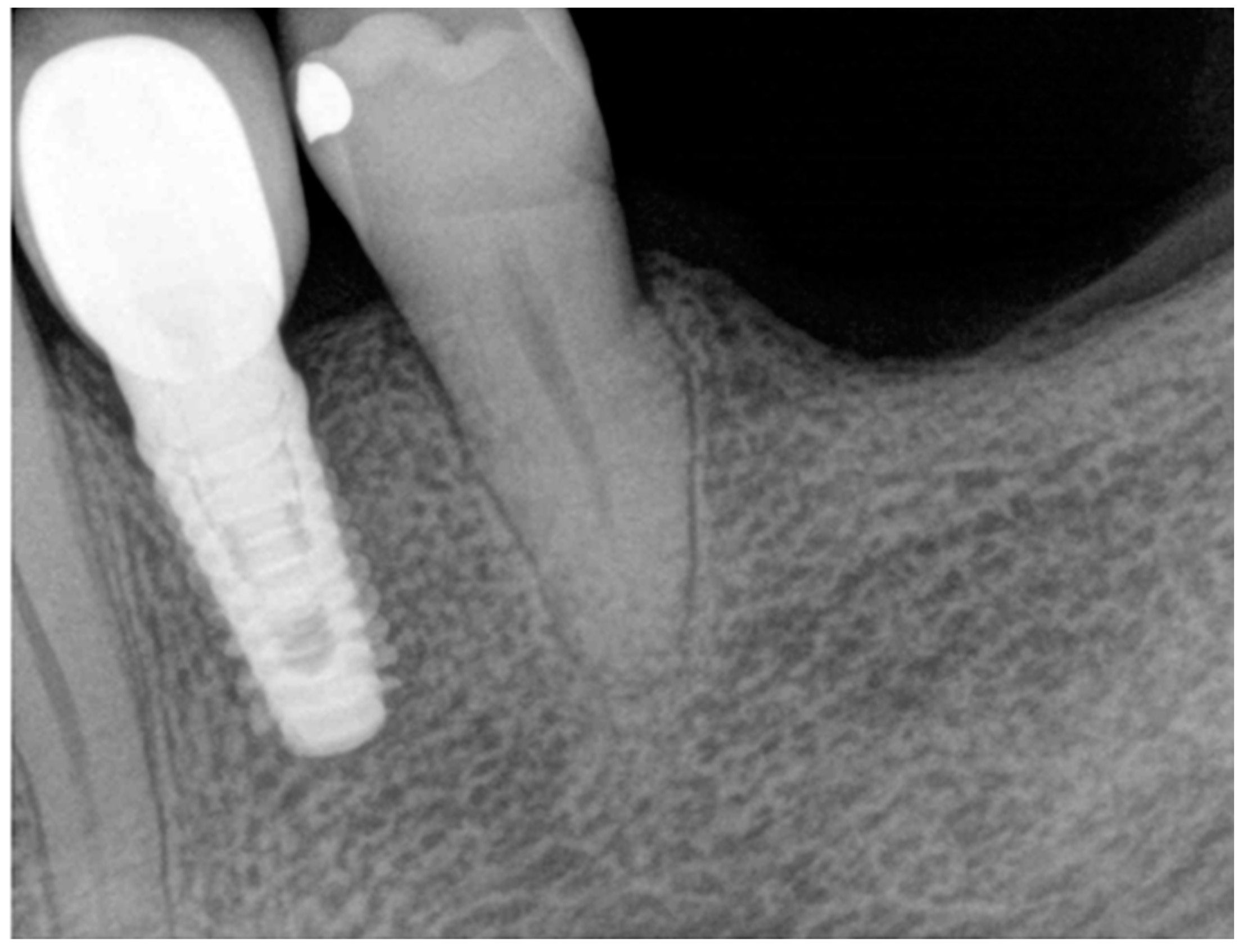 Medicina 60 01912 g008