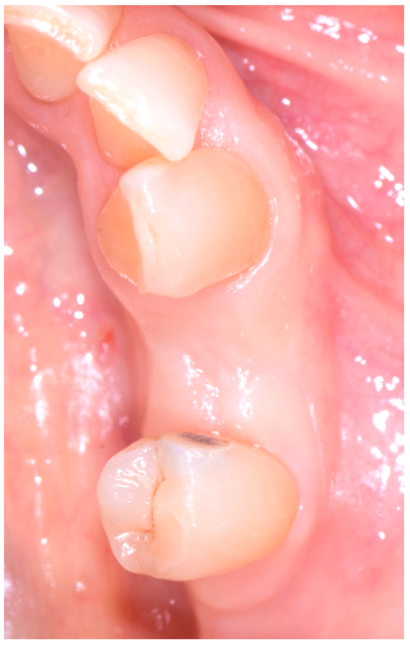 Medicina 60 01912 g010