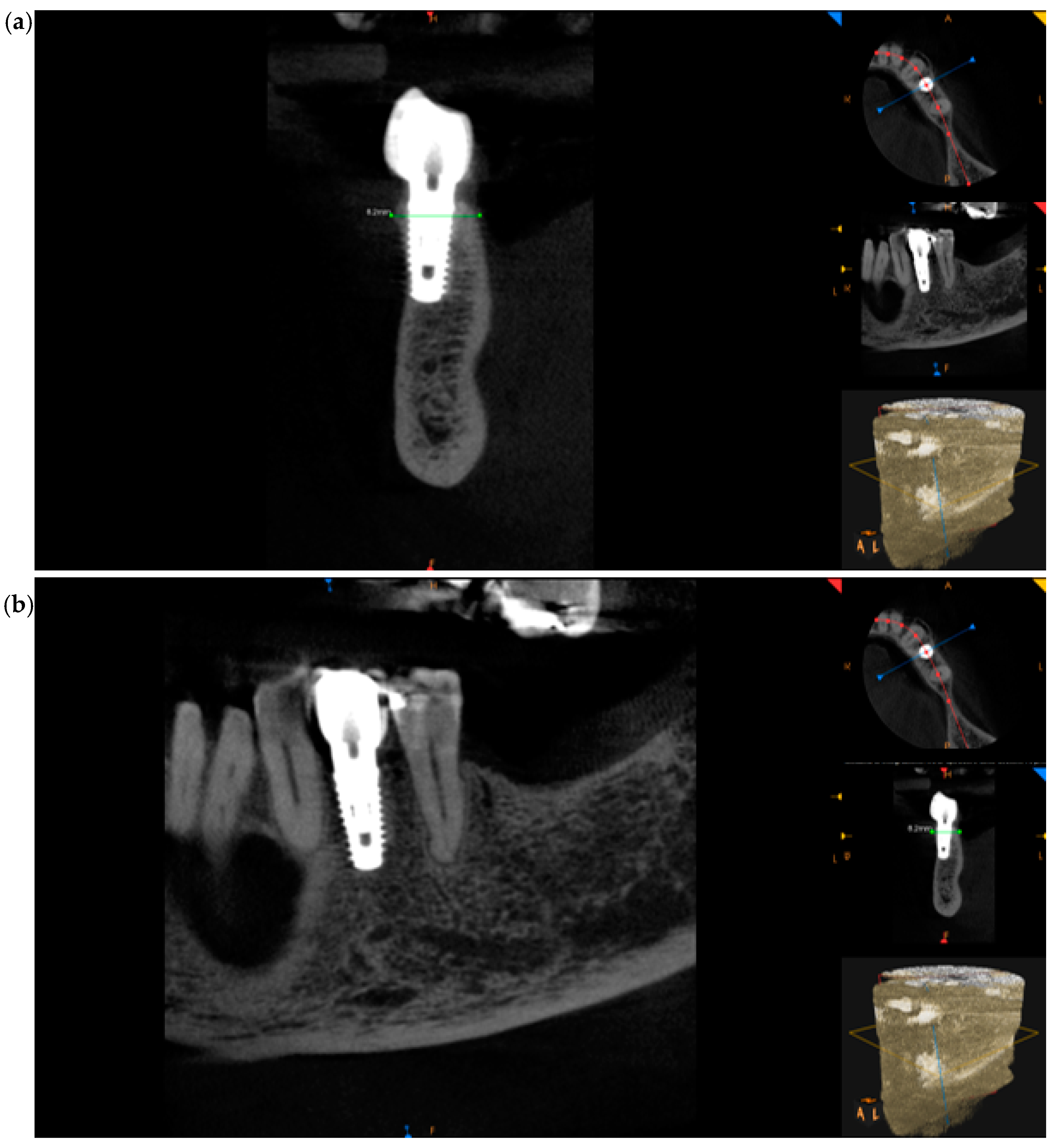Medicina 60 01912 g011