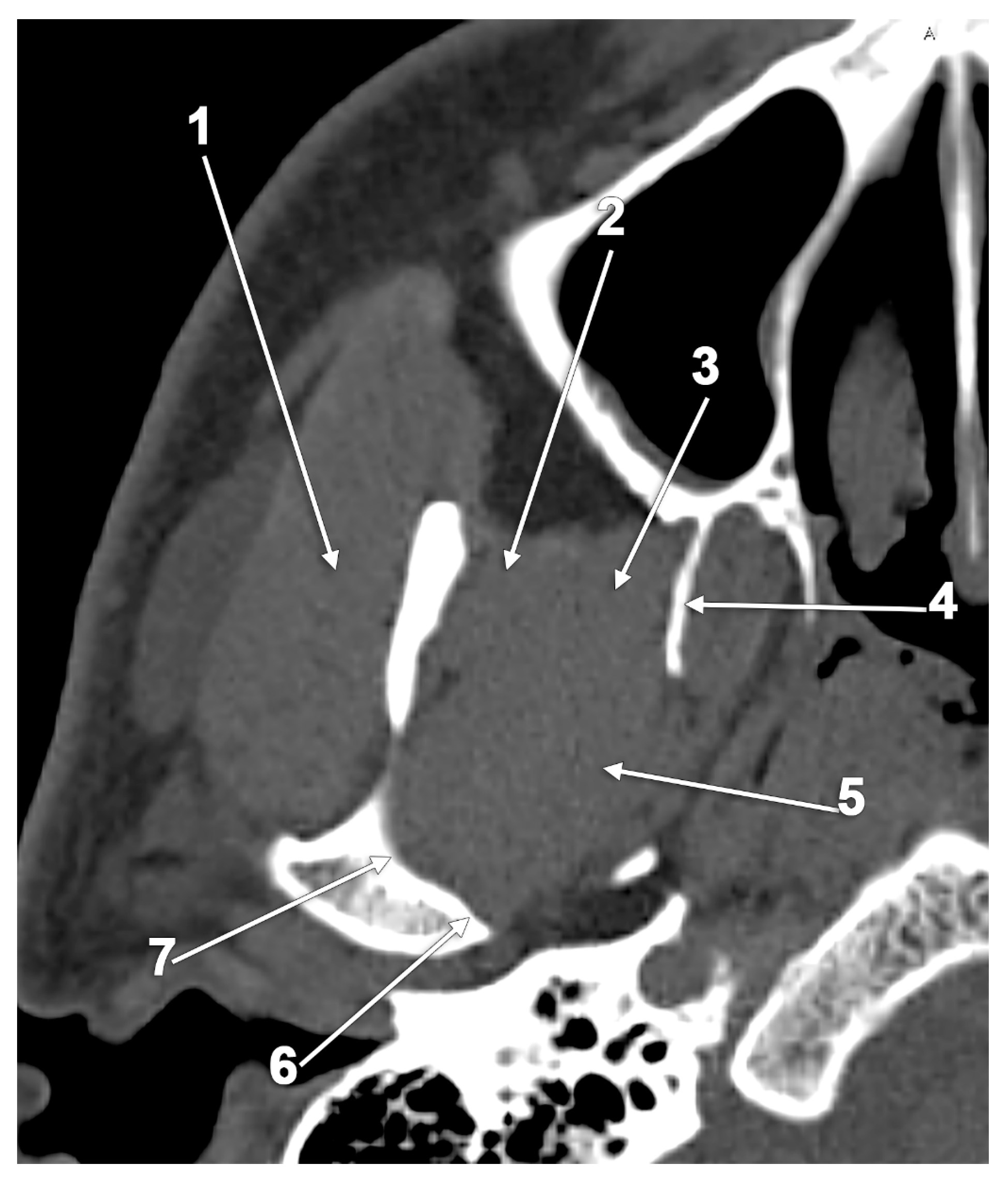Medicina 60 01913 g004
