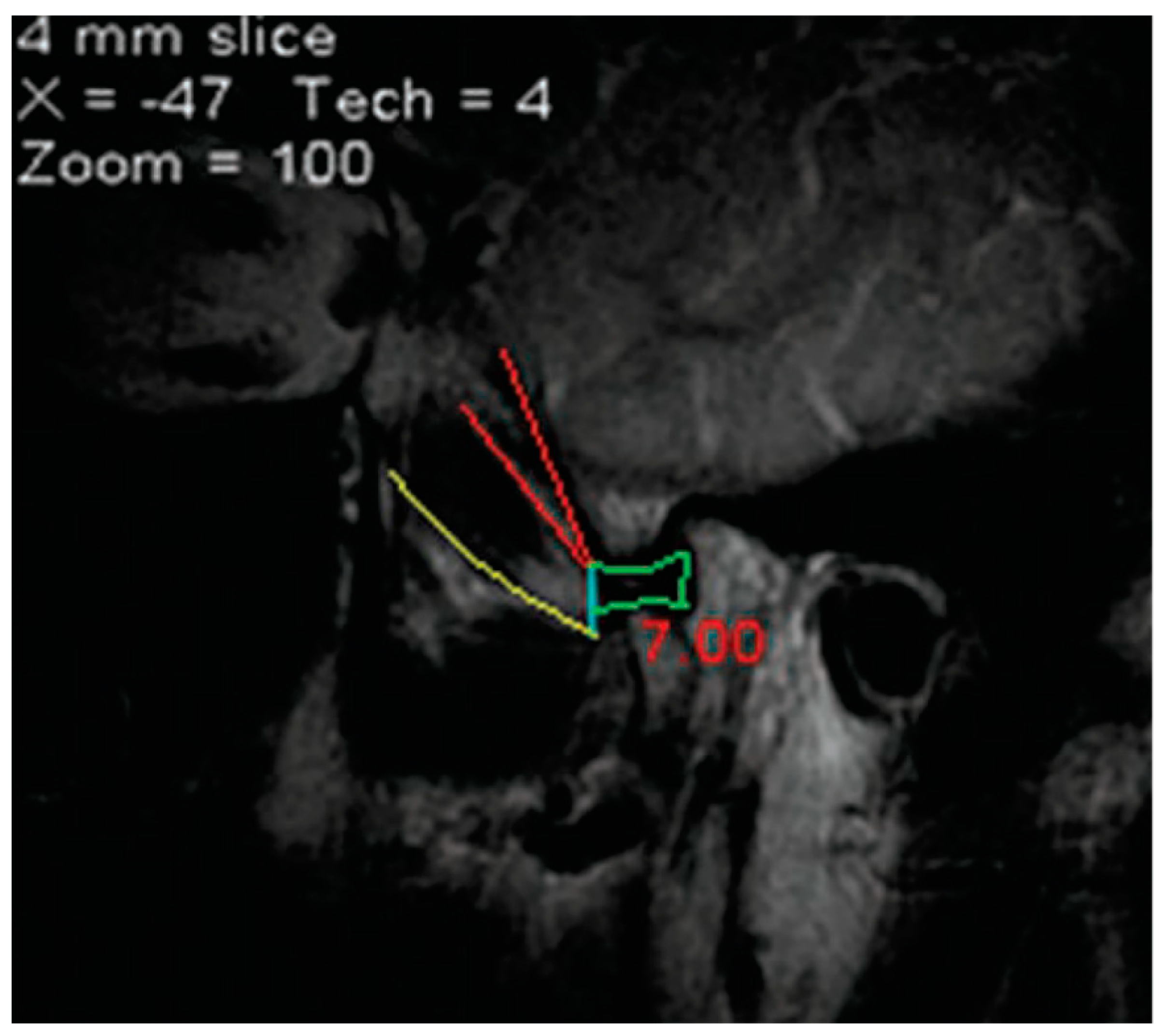 Medicina 60 01913 g006