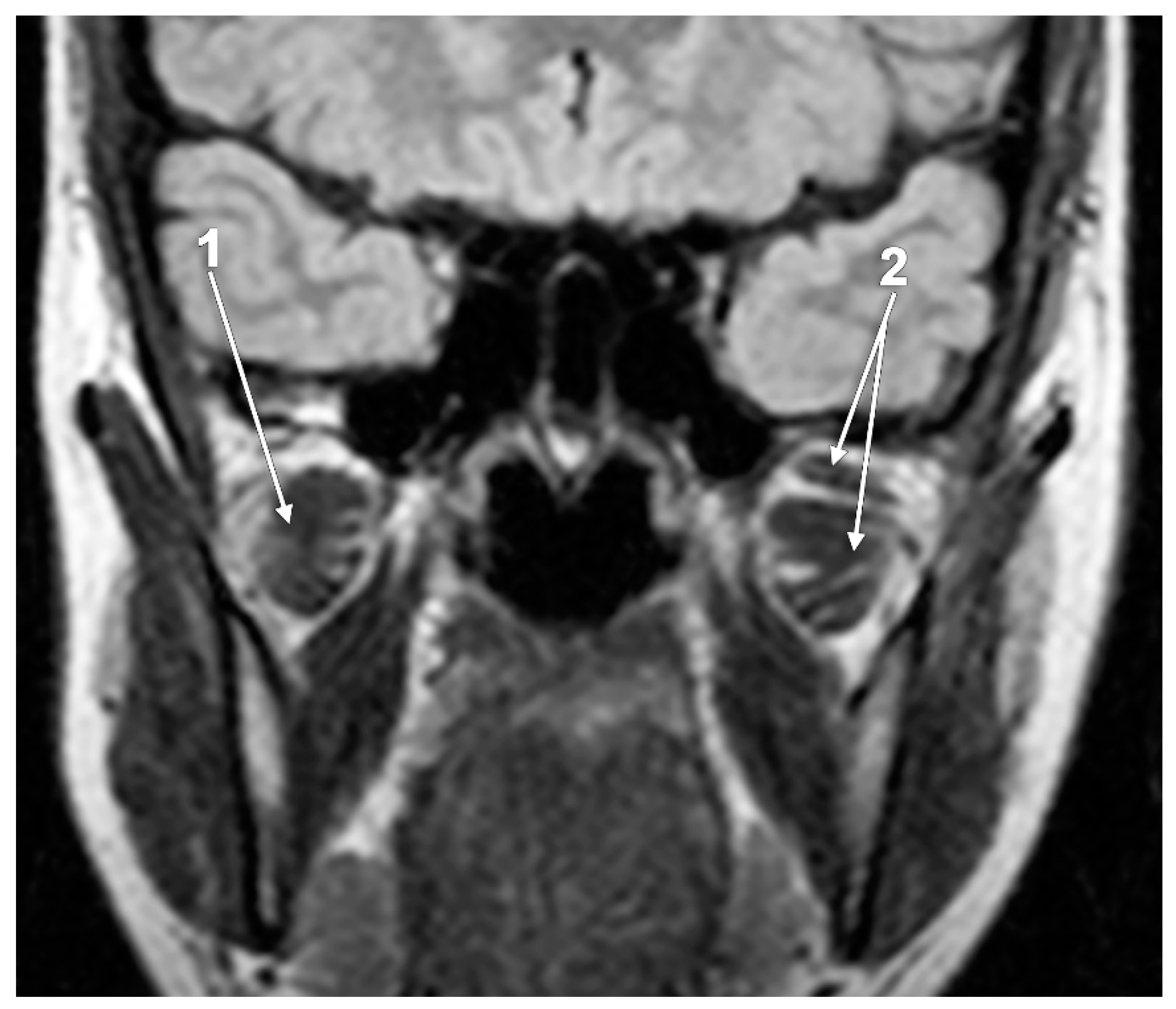 Medicina 60 01913 g007