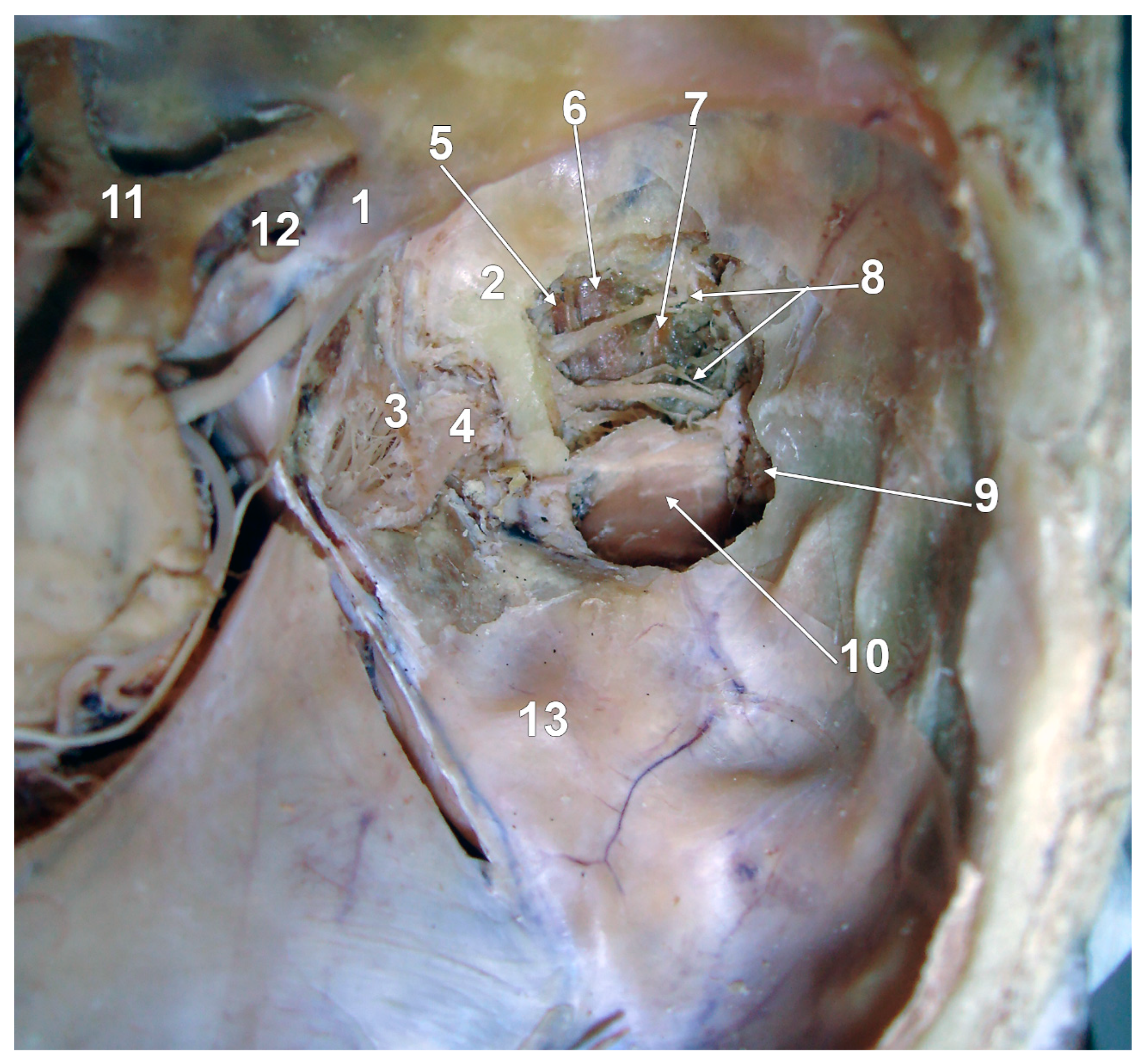 Medicina 60 01913 g008