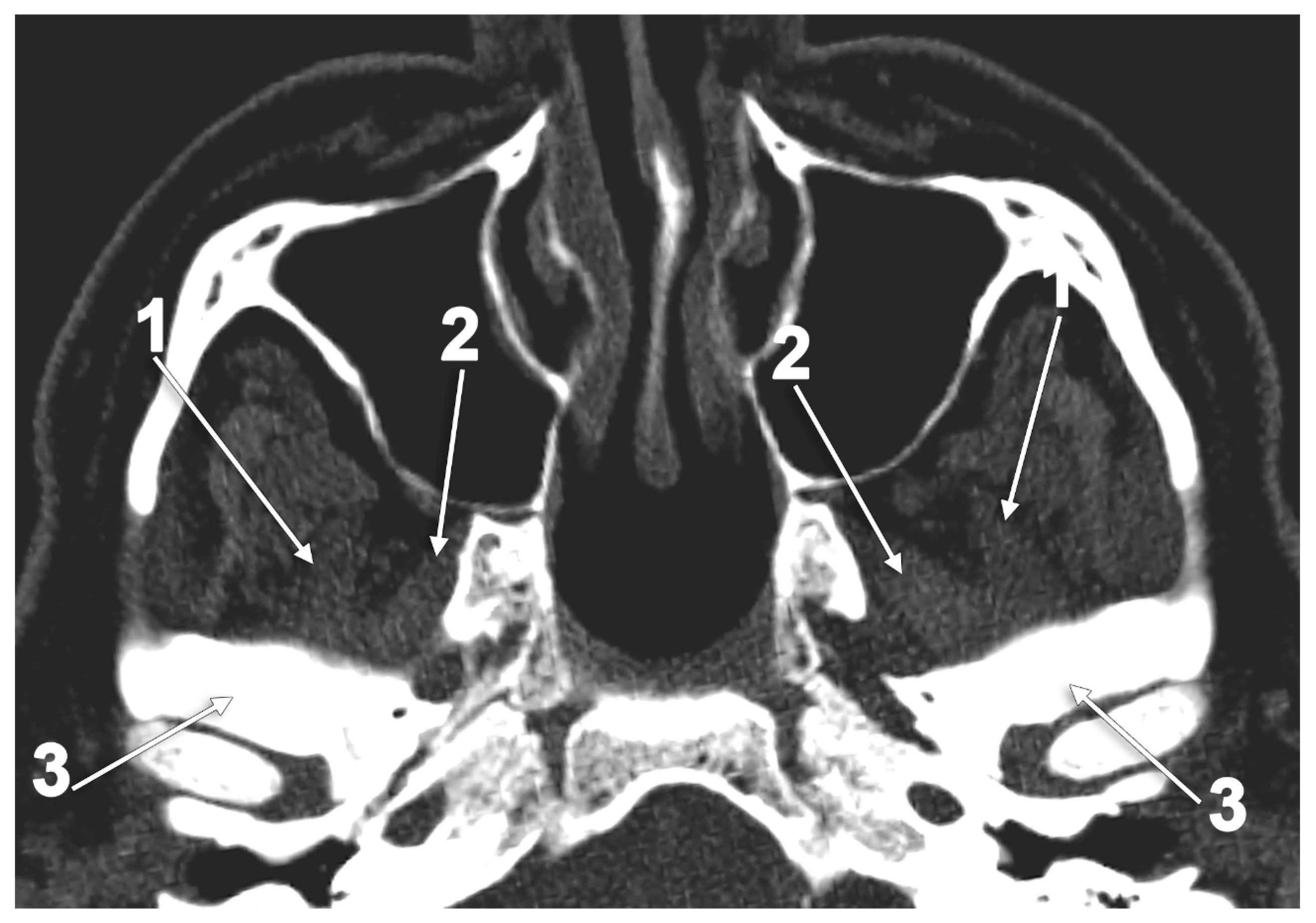 Medicina 60 01913 g009