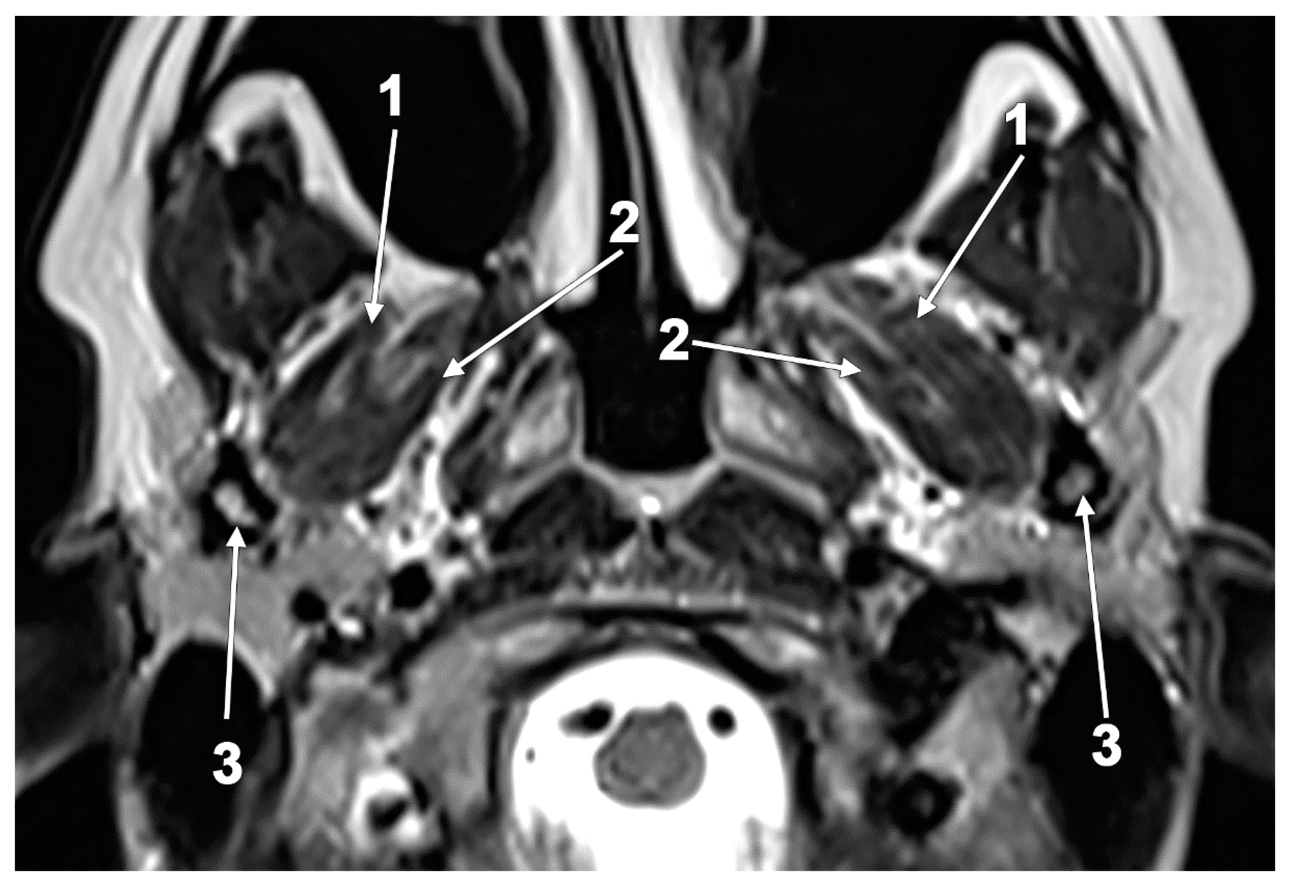 Medicina 60 01913 g010