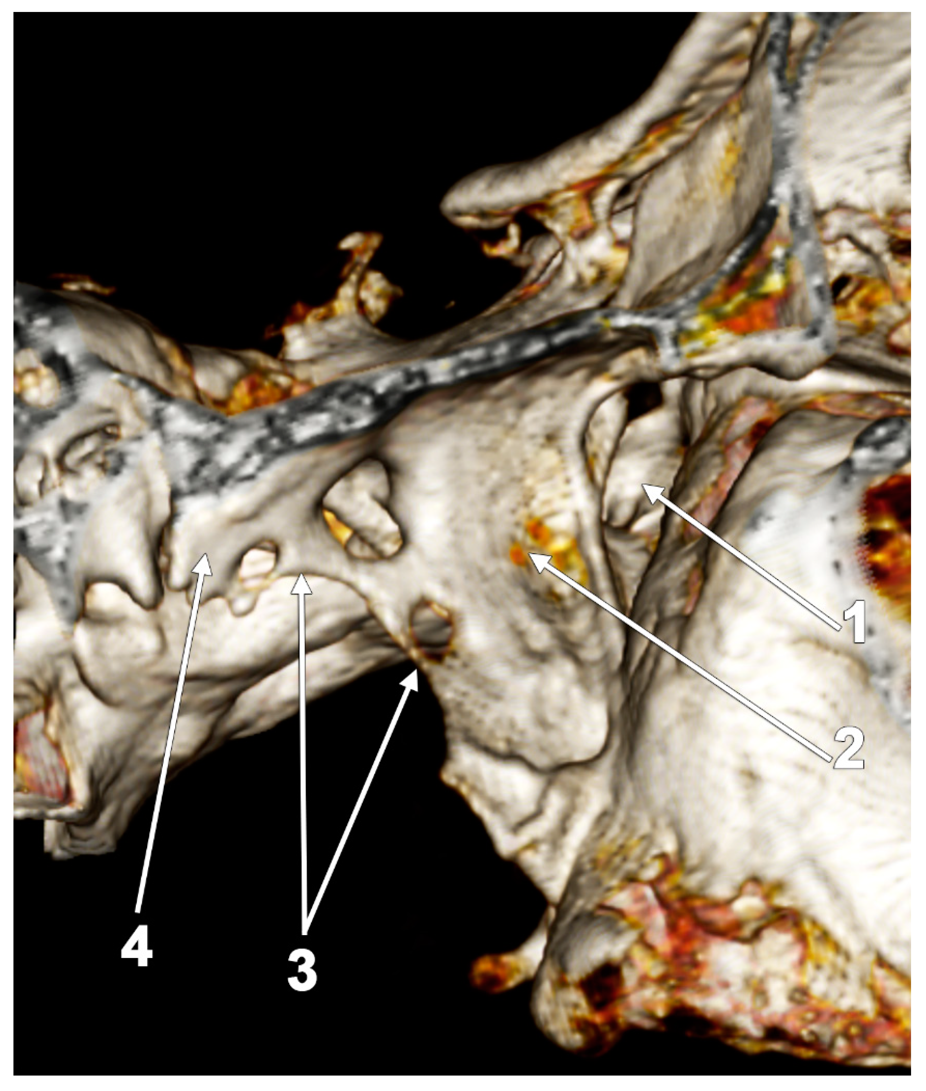 Medicina 60 01913 g014