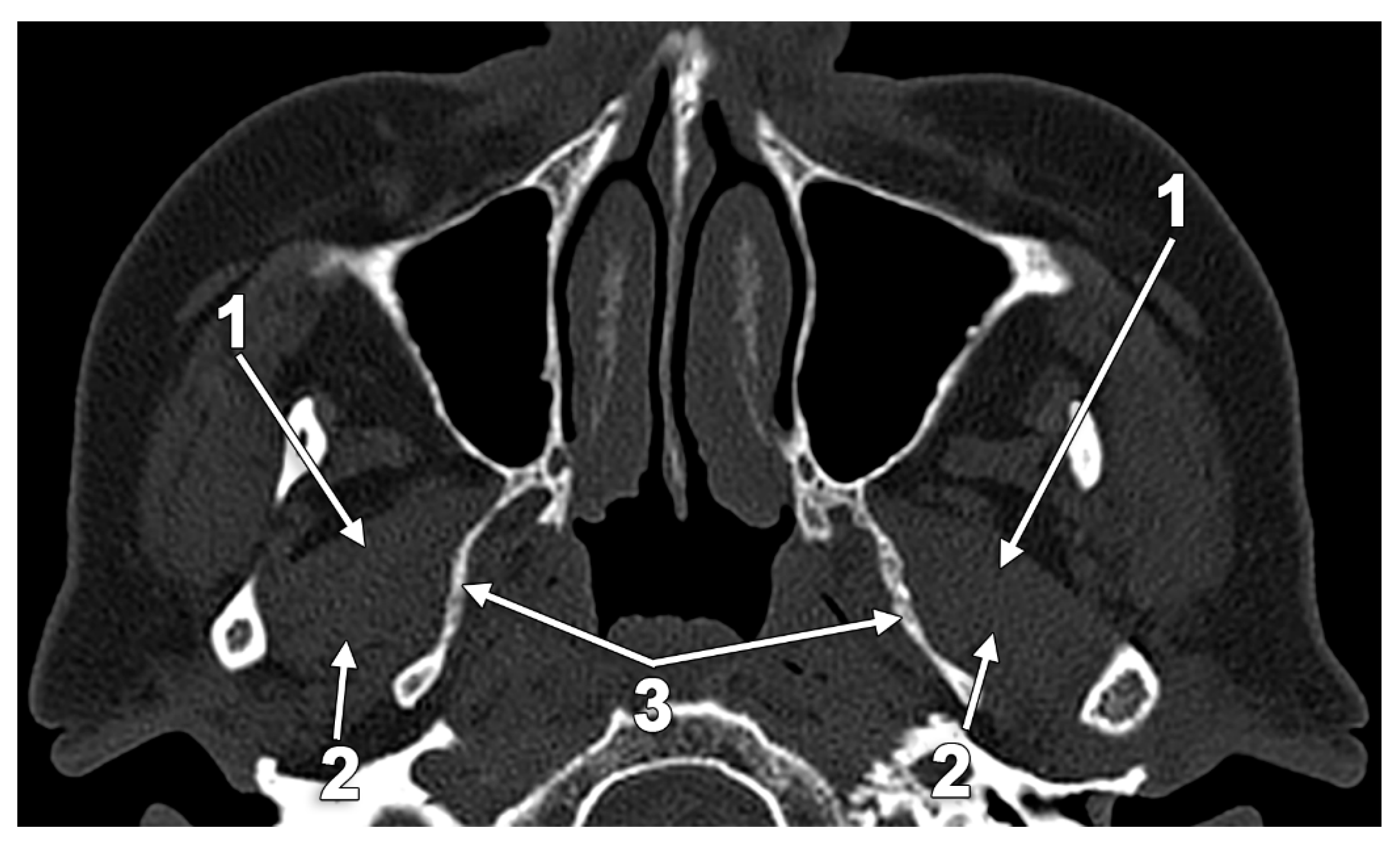 Medicina 60 01913 g015